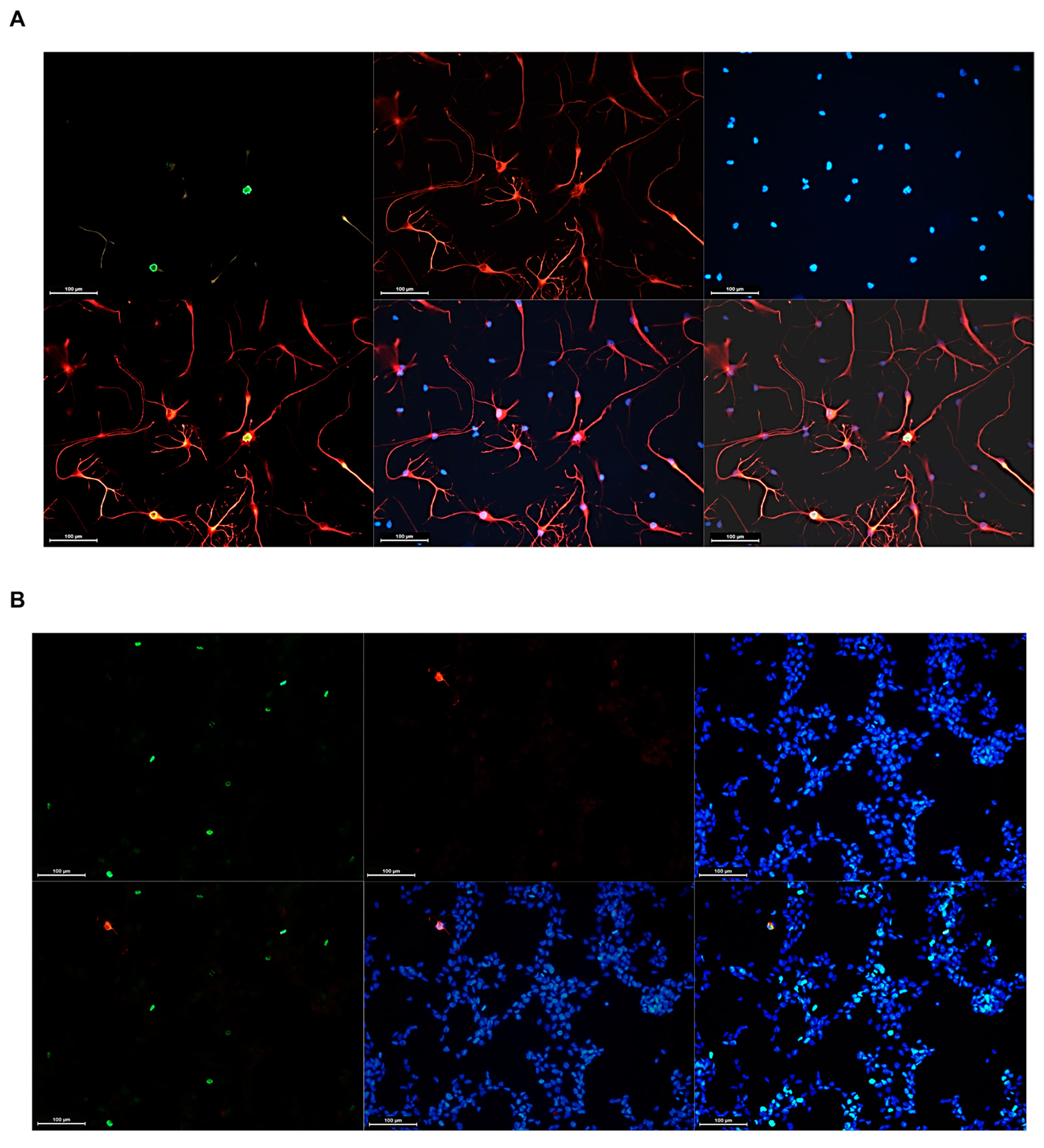 Cells 13 01802 g009a Cells 13 01802 g009a