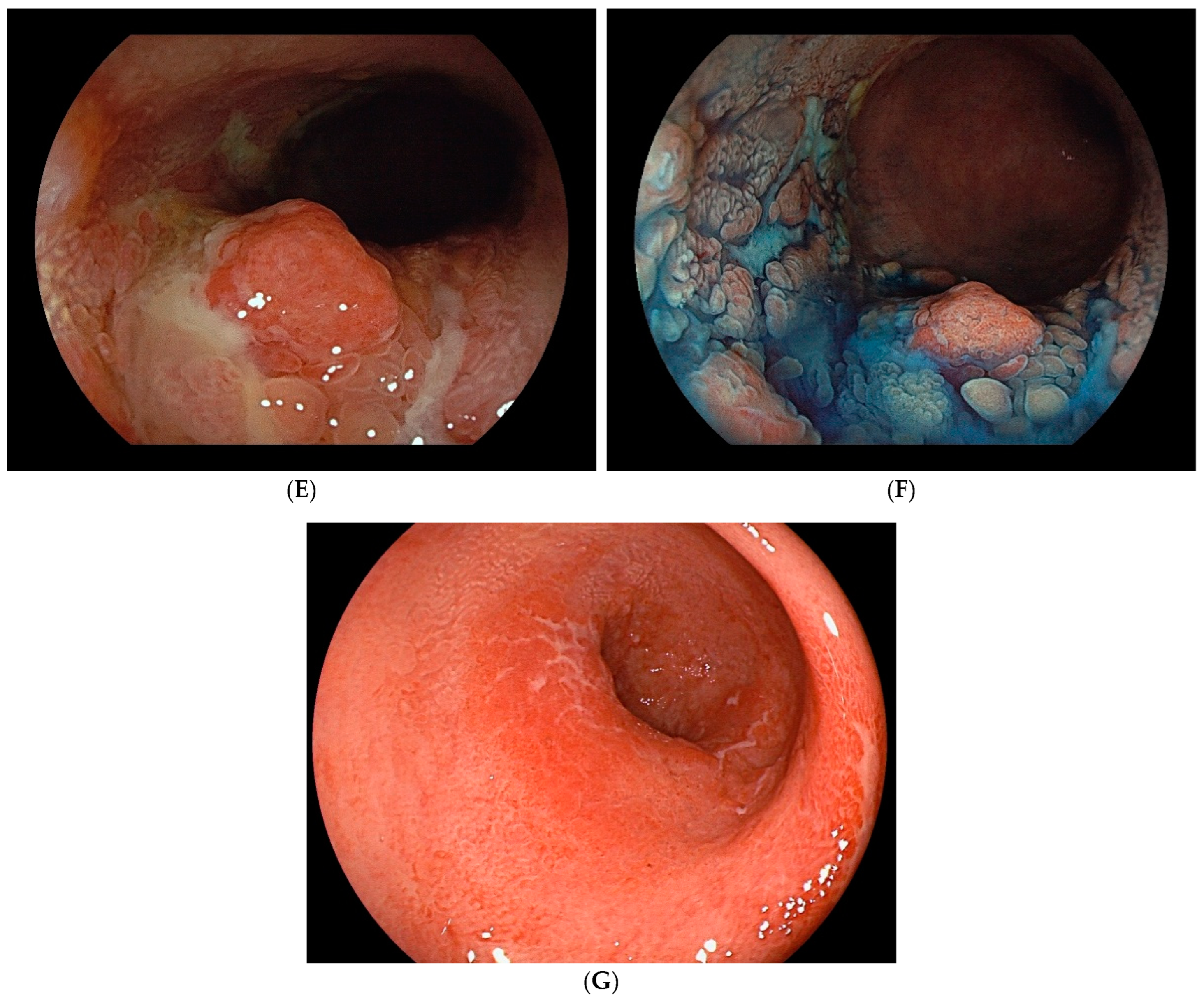 Cells 14 00567 g001b