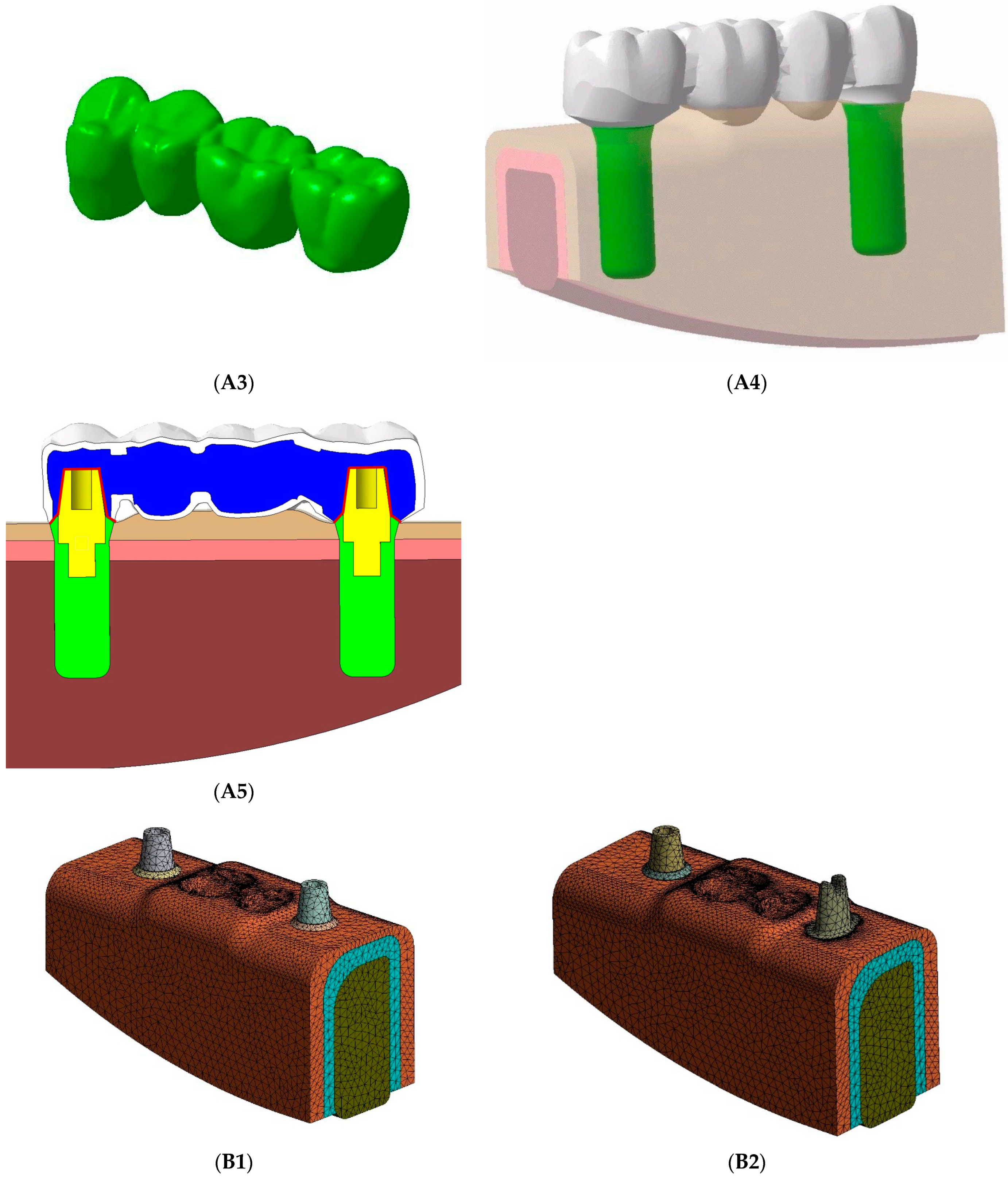 Ceramics 07 00079 g001b