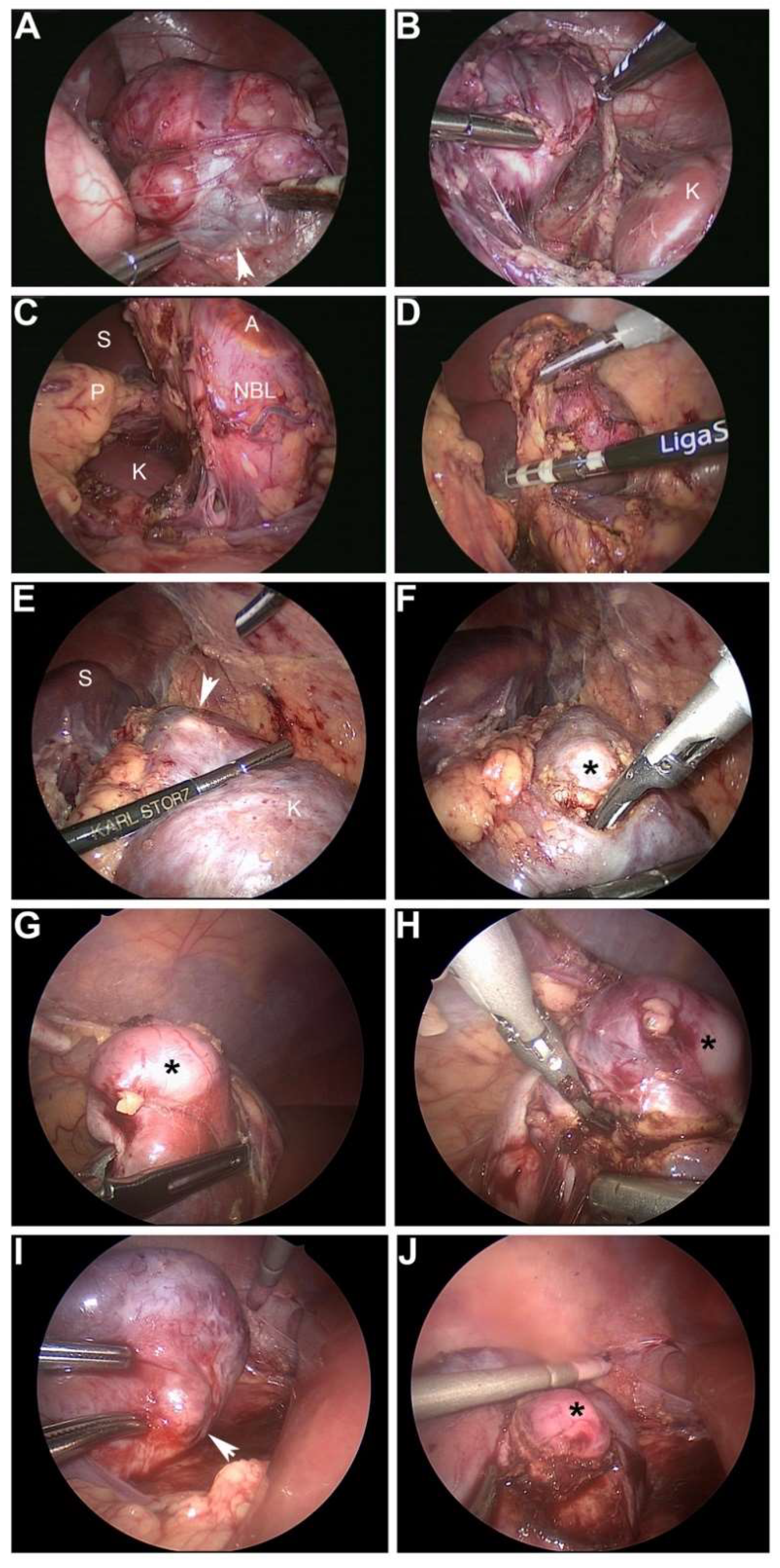 Children 05 00158 g002 Children 05 00158 g002