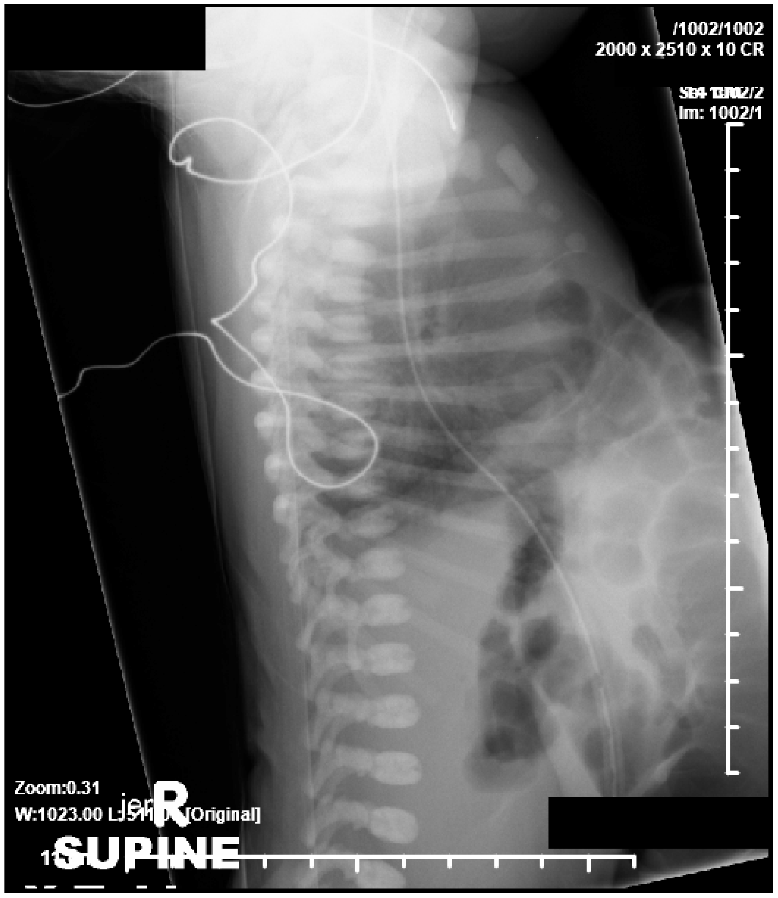 Children 06 00109 g002