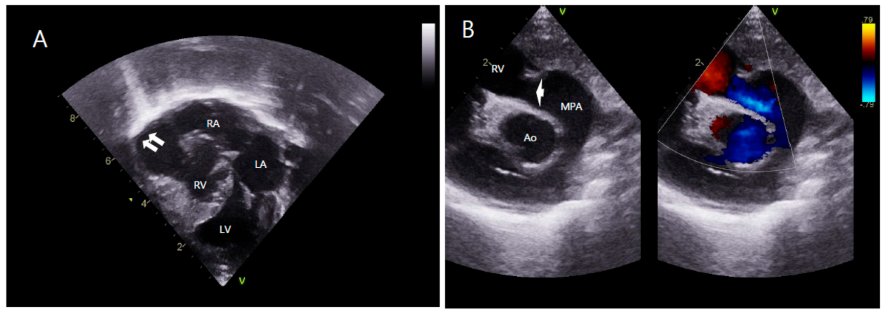 Children 08 00190 g002 Children 08 00190 g002