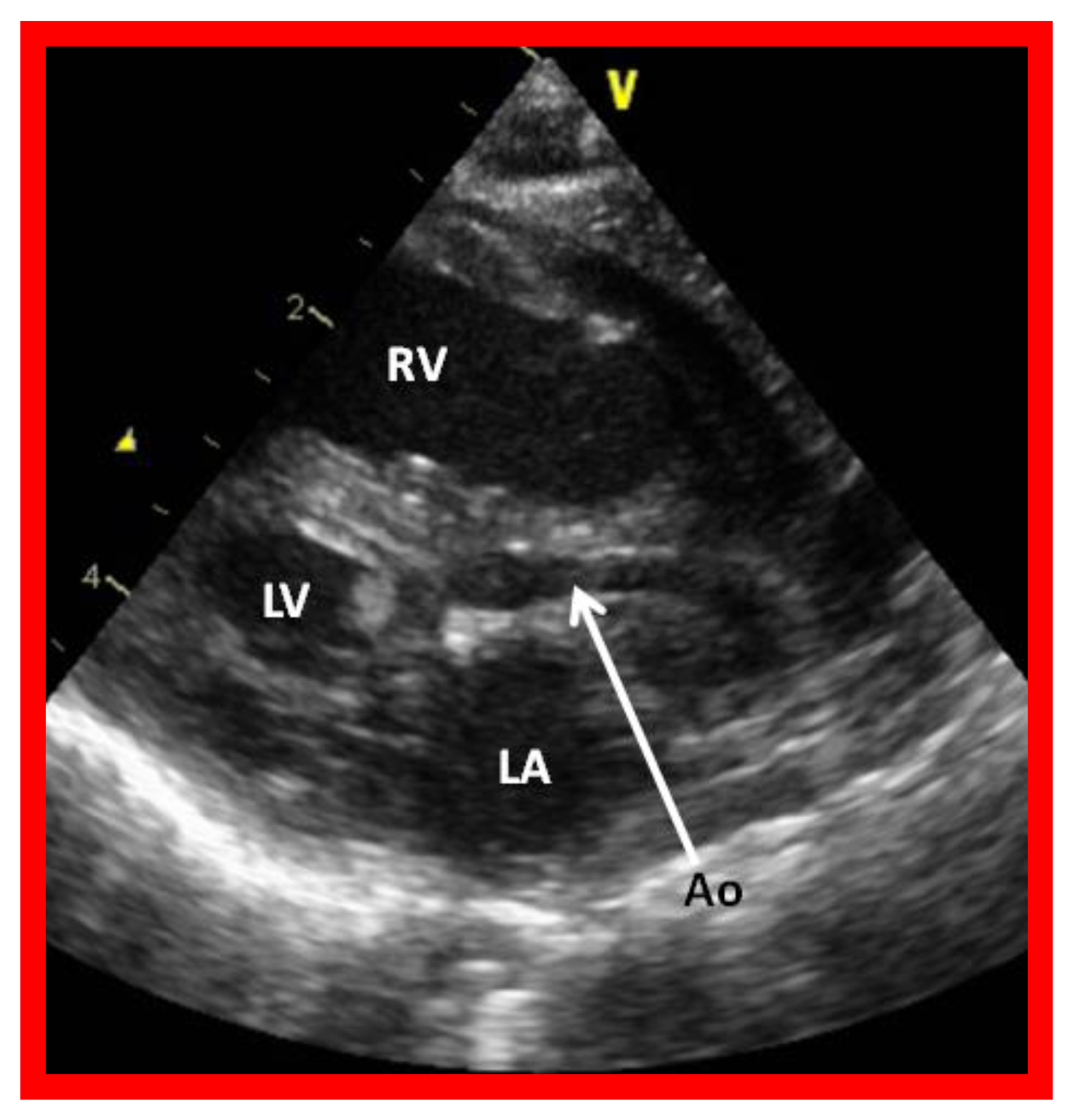 Children 08 00441 g002 Children 08 00441 g002