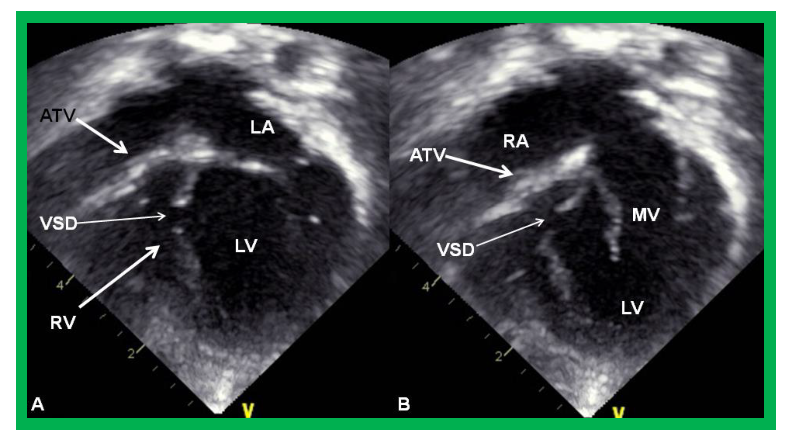 Children 08 00441 g003 Children 08 00441 g003