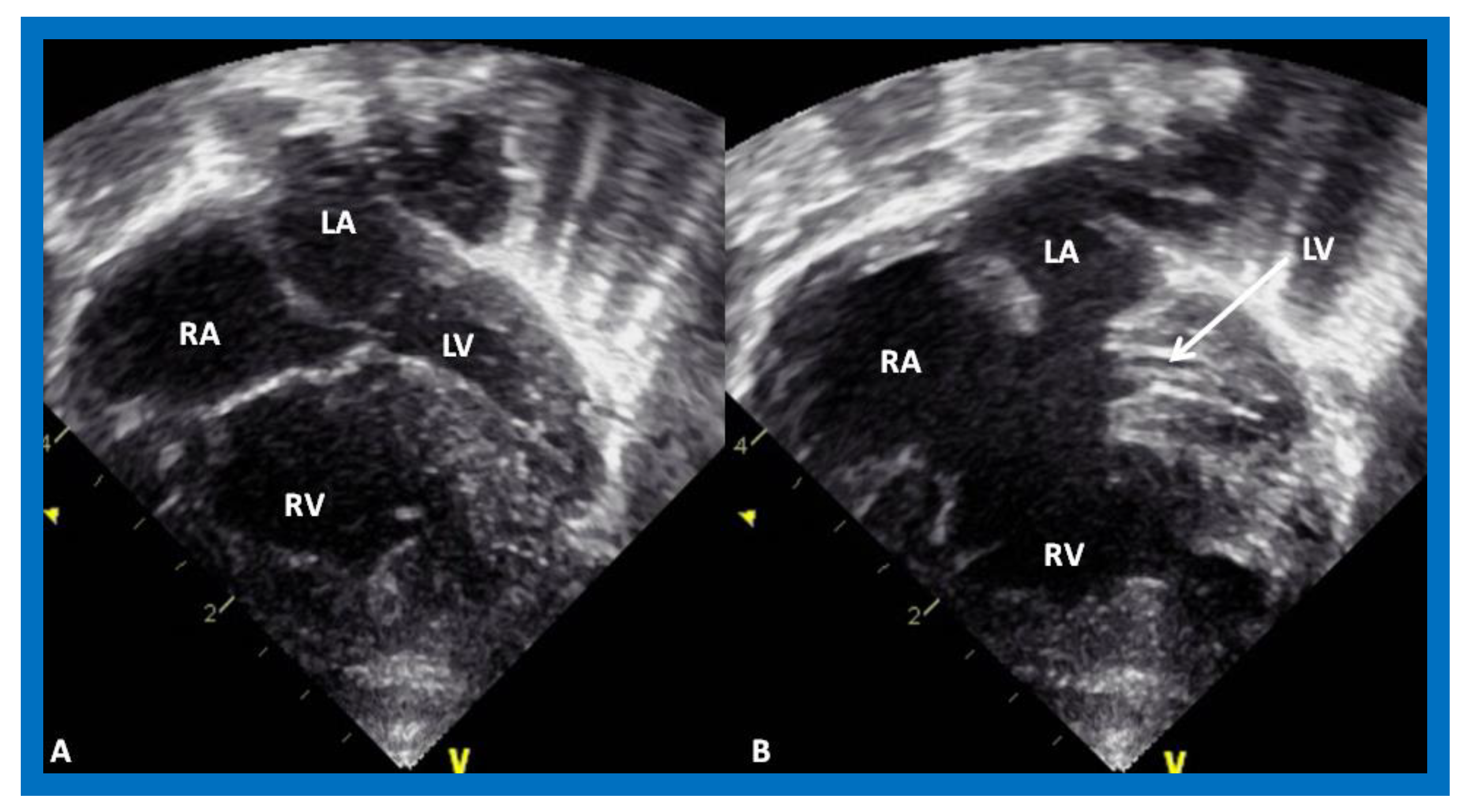 Children 08 00441 g005 Children 08 00441 g005