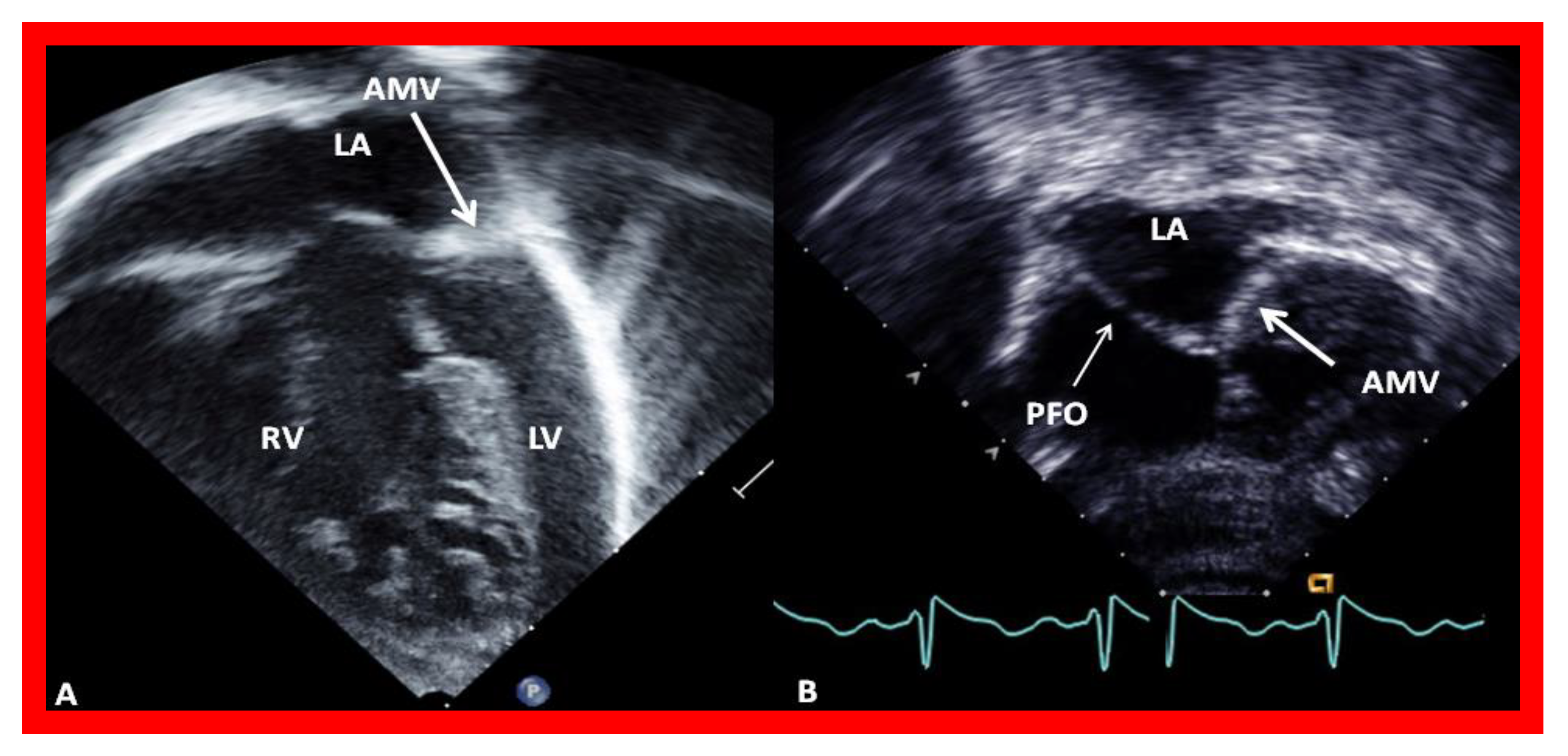 Children 08 00441 g006 Children 08 00441 g006