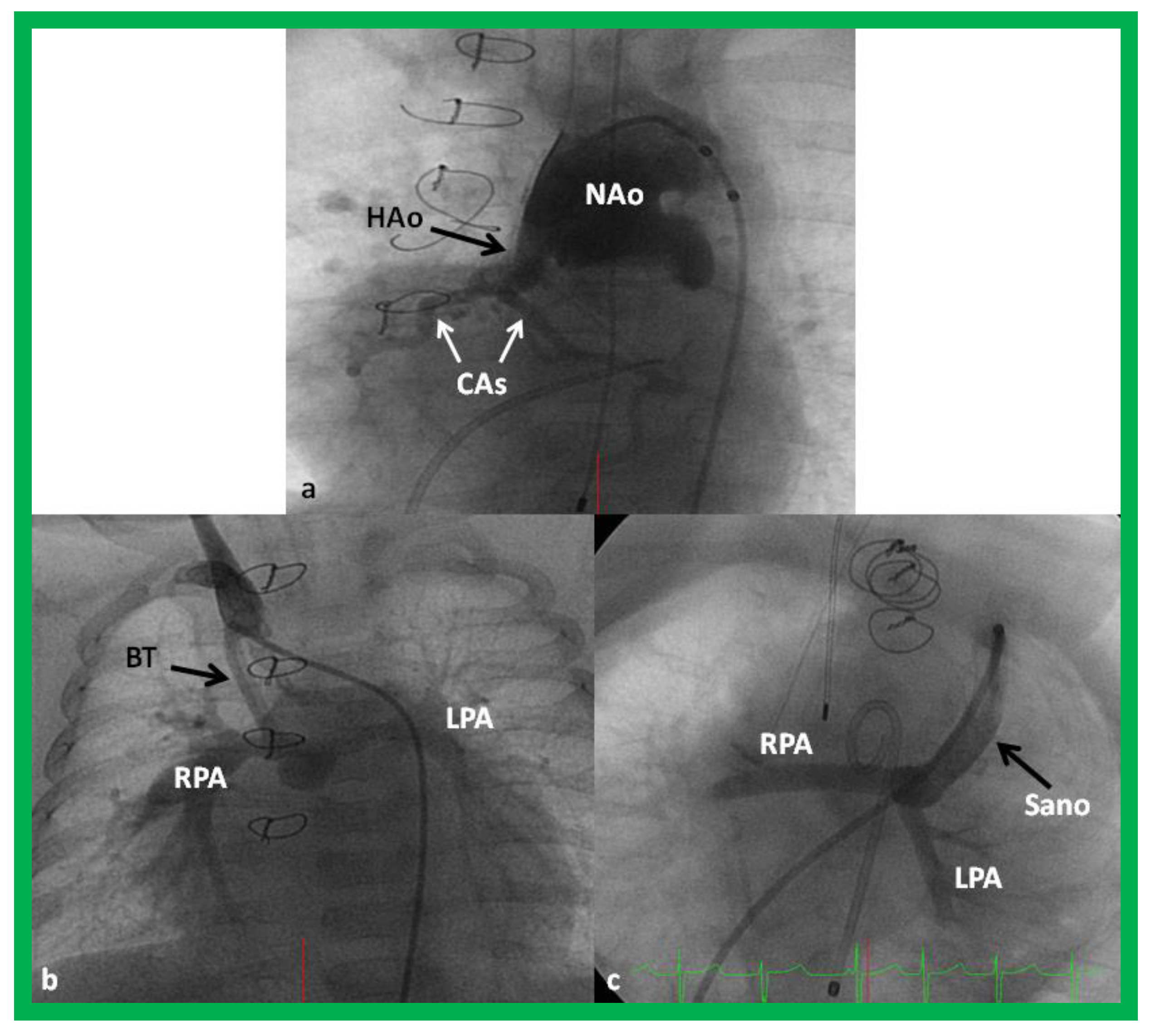 Children 08 00441 g011 Children 08 00441 g011