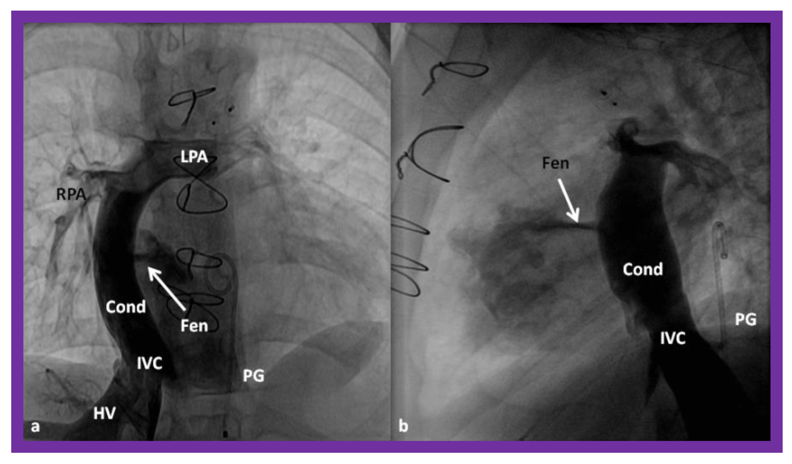 Children 08 00441 g016 Children 08 00441 g016