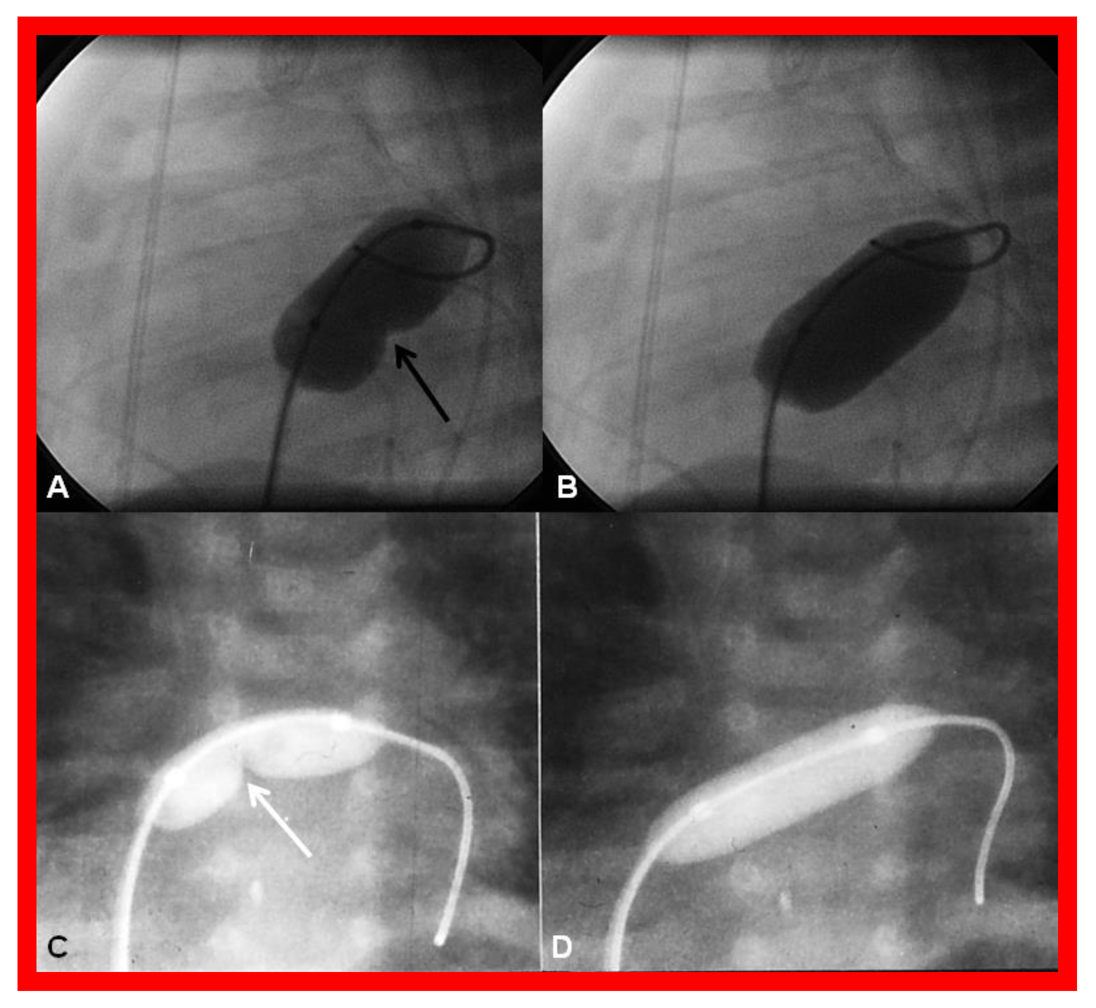 Children 08 00441 g018 Children 08 00441 g018