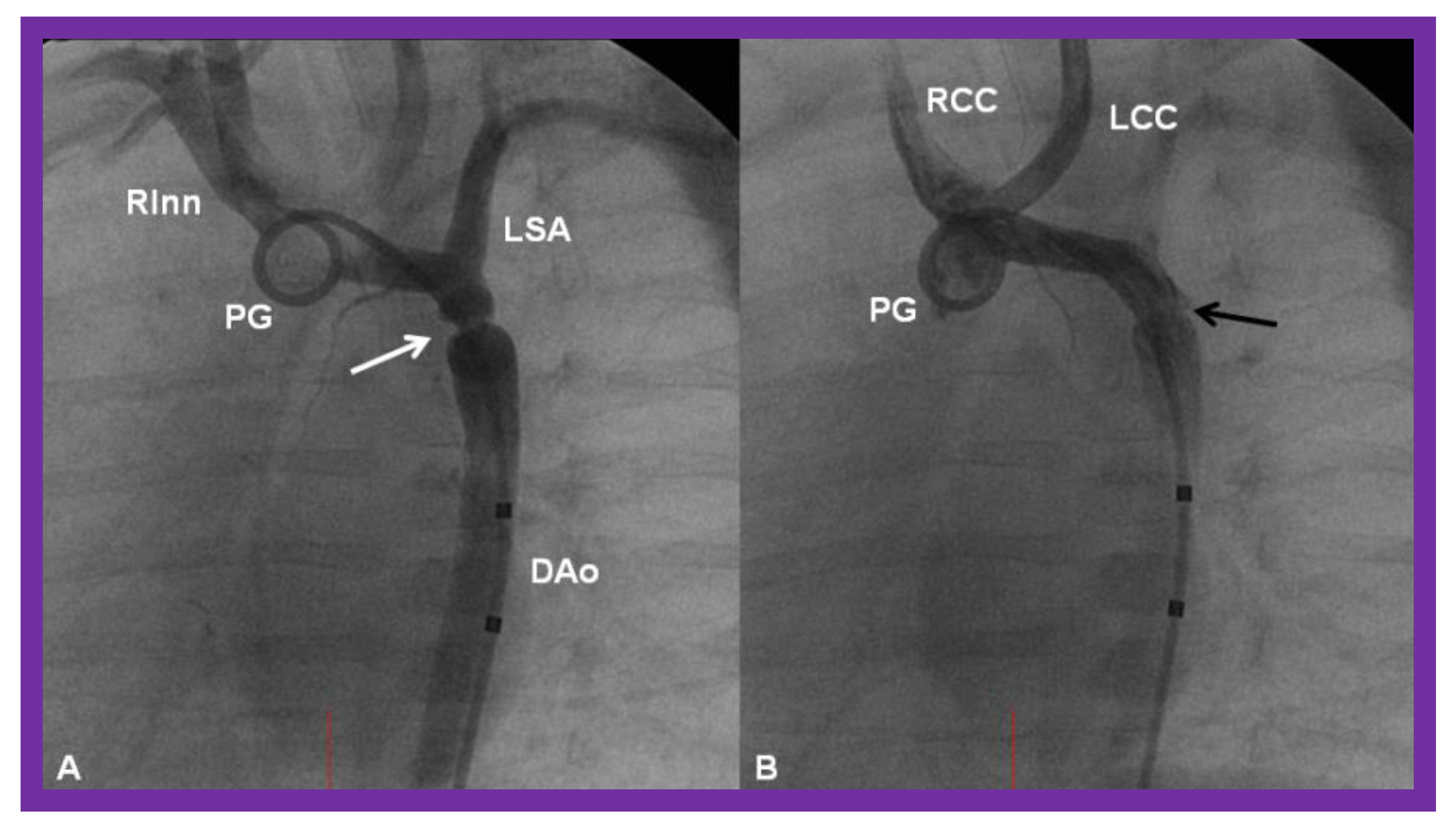 Children 08 00441 g024 Children 08 00441 g024