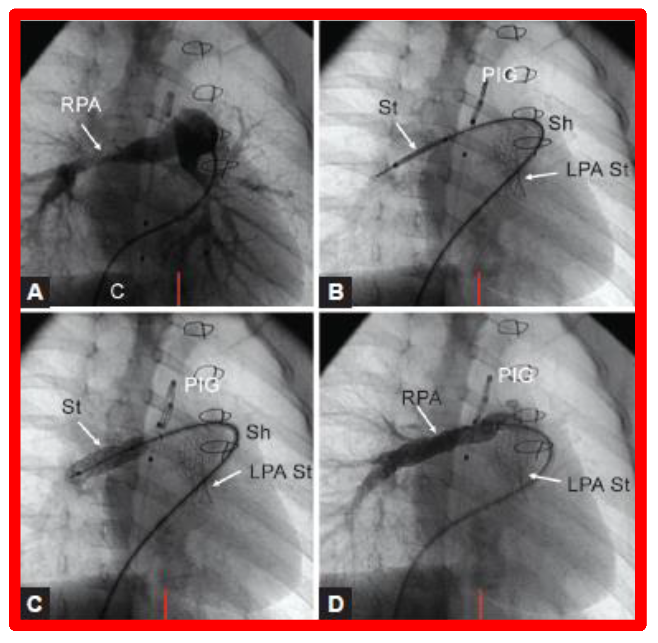 Children 08 00441 g026 Children 08 00441 g026