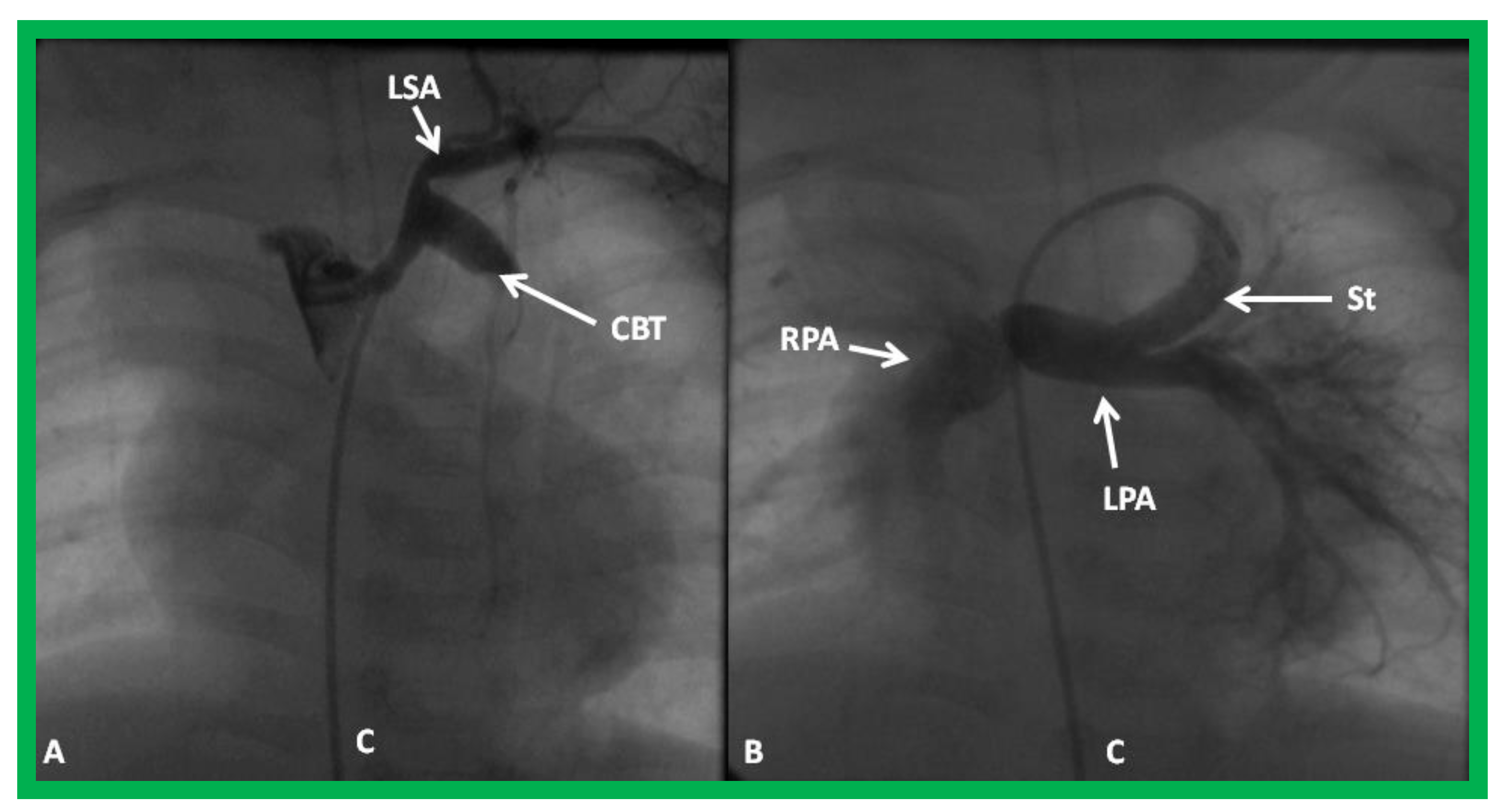 Children 08 00441 g027 Children 08 00441 g027
