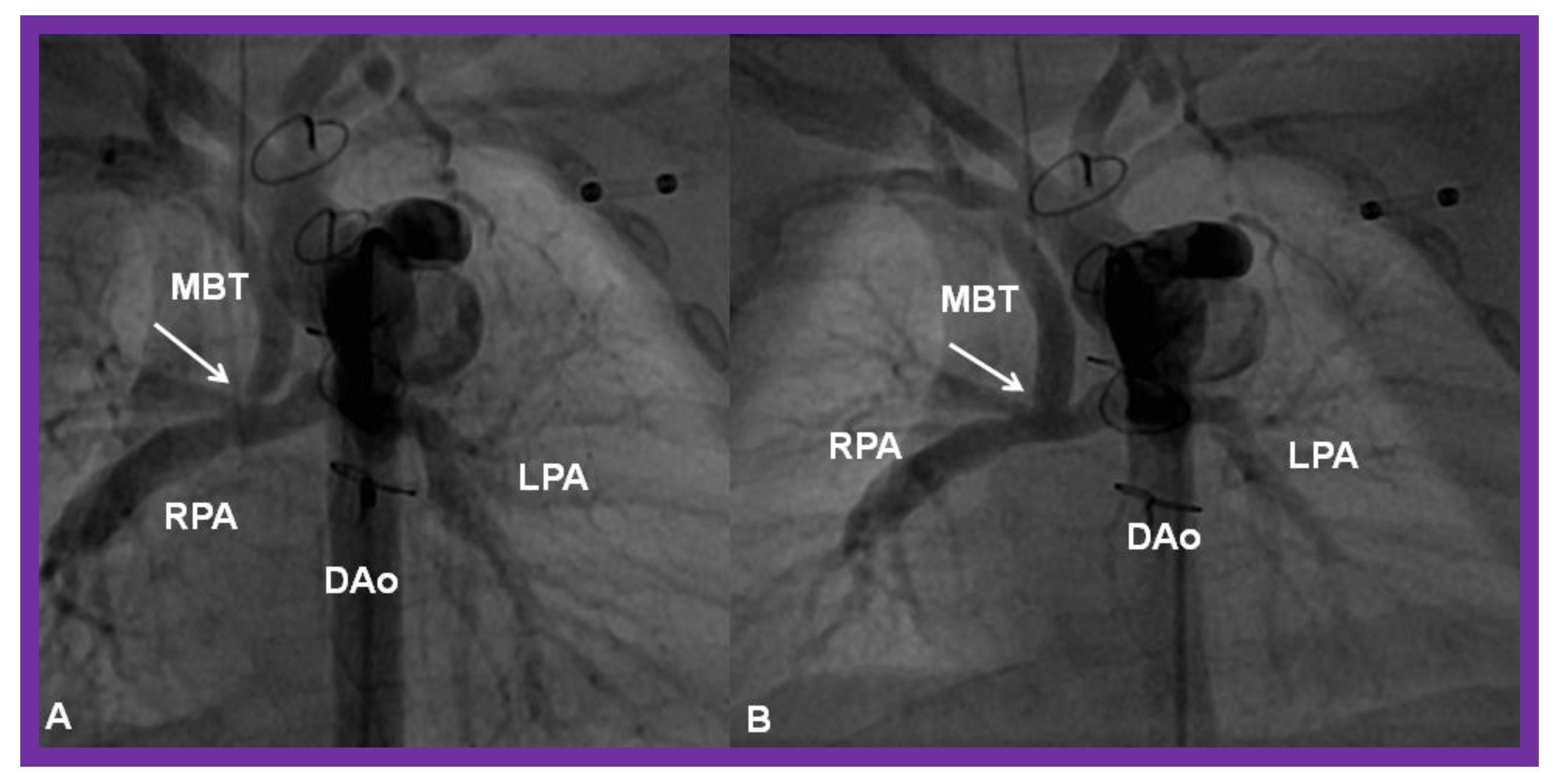 Children 08 00441 g028 Children 08 00441 g028