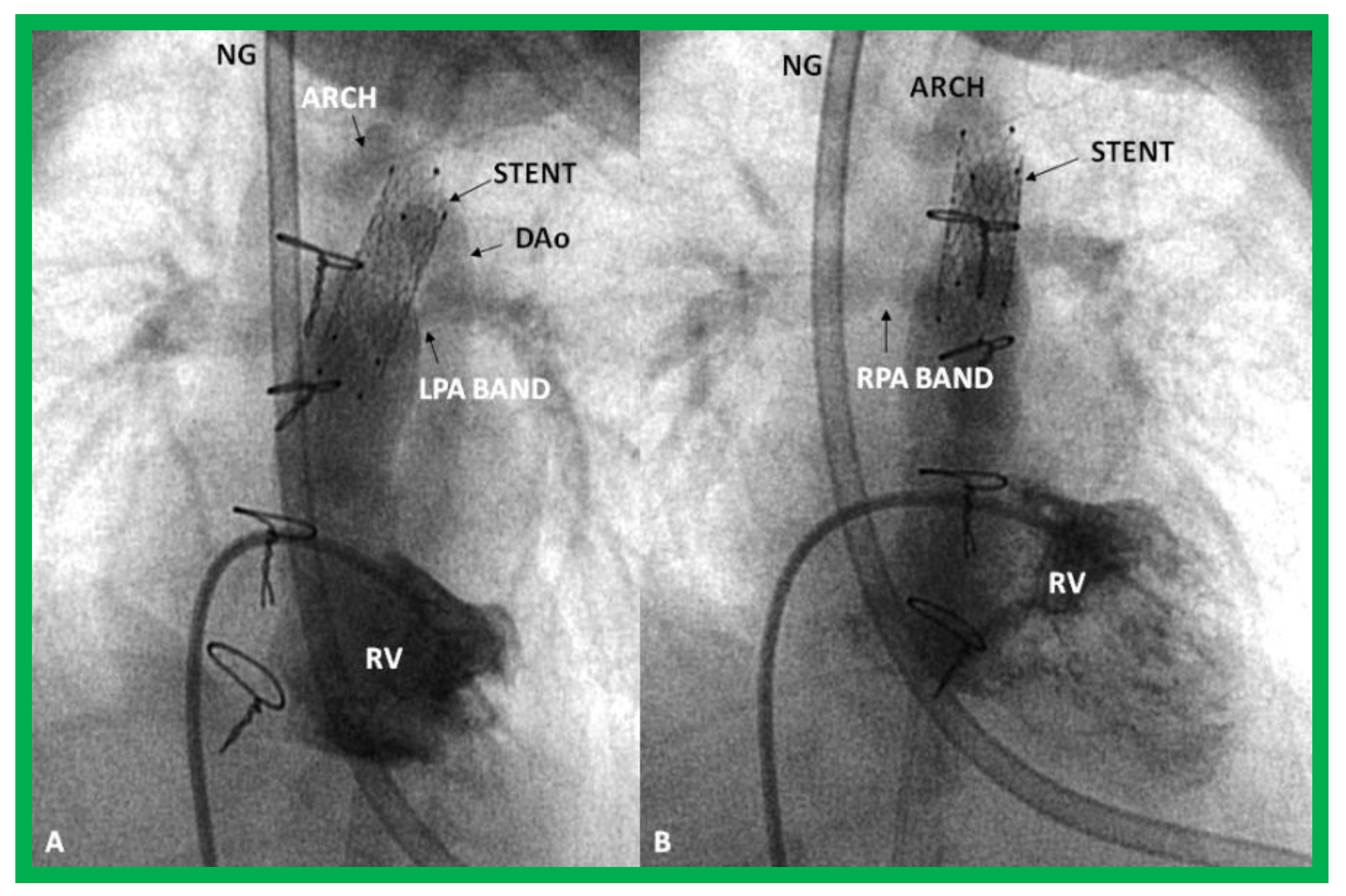 Children 08 00441 g031 Children 08 00441 g031