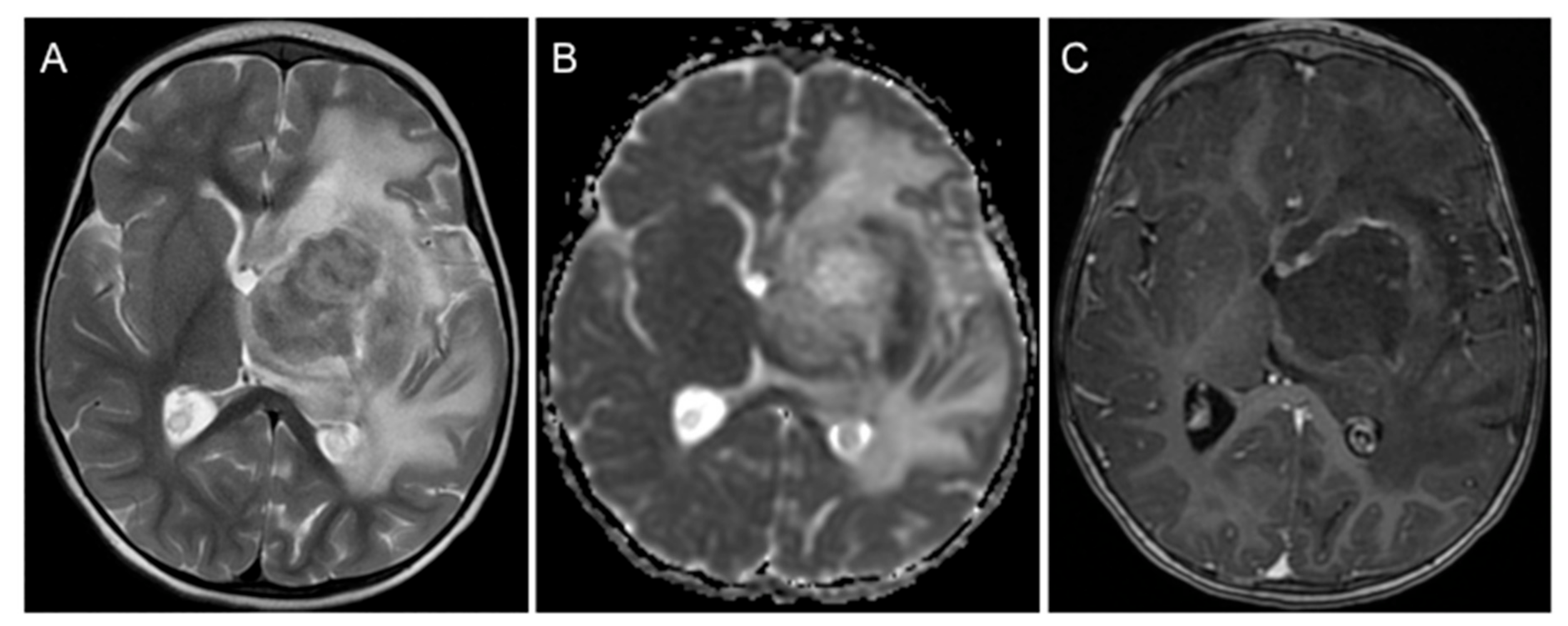 Children 08 00469 g001 Children 08 00469 g001