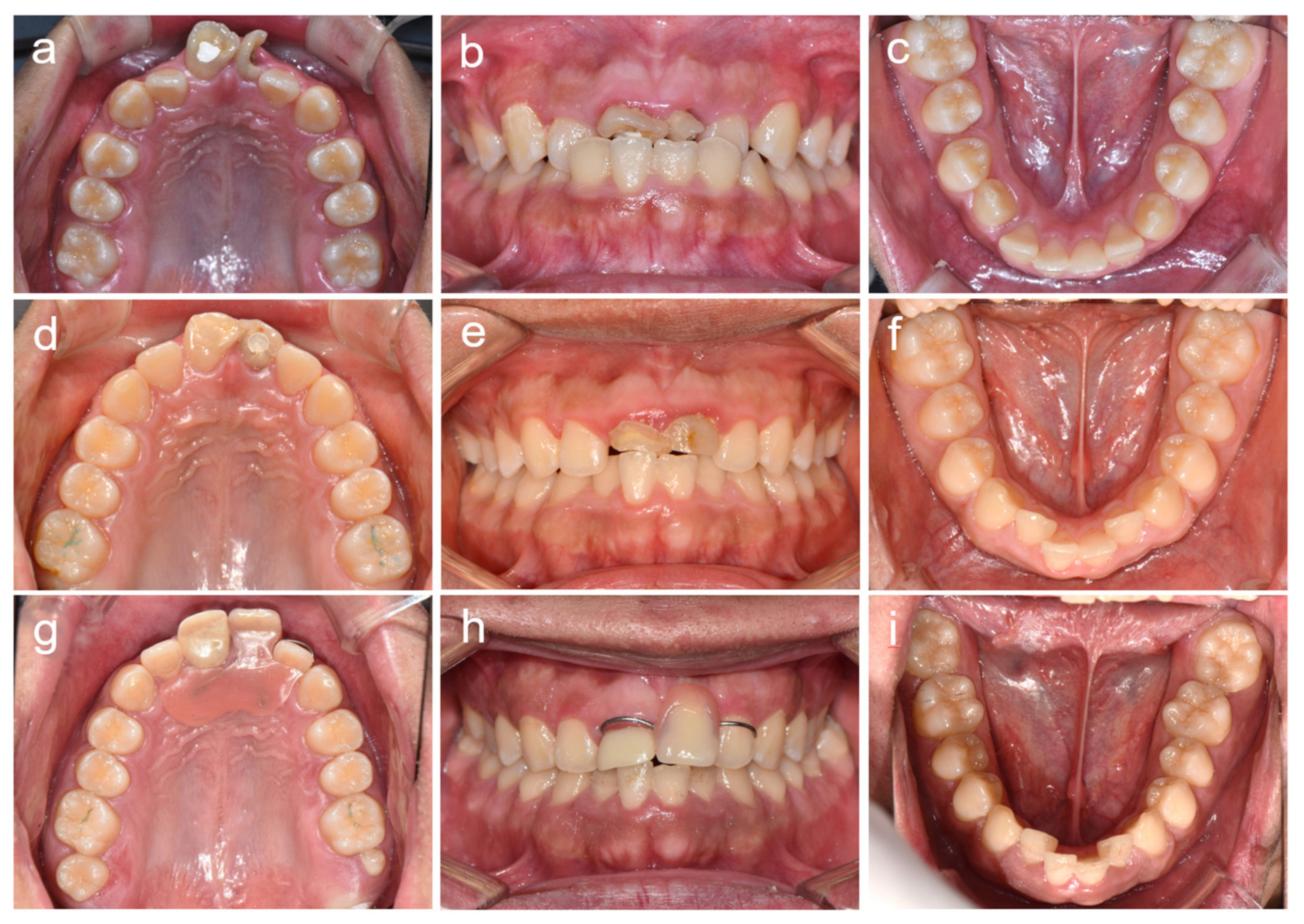 Children 08 00904 g002 Children 08 00904 g002