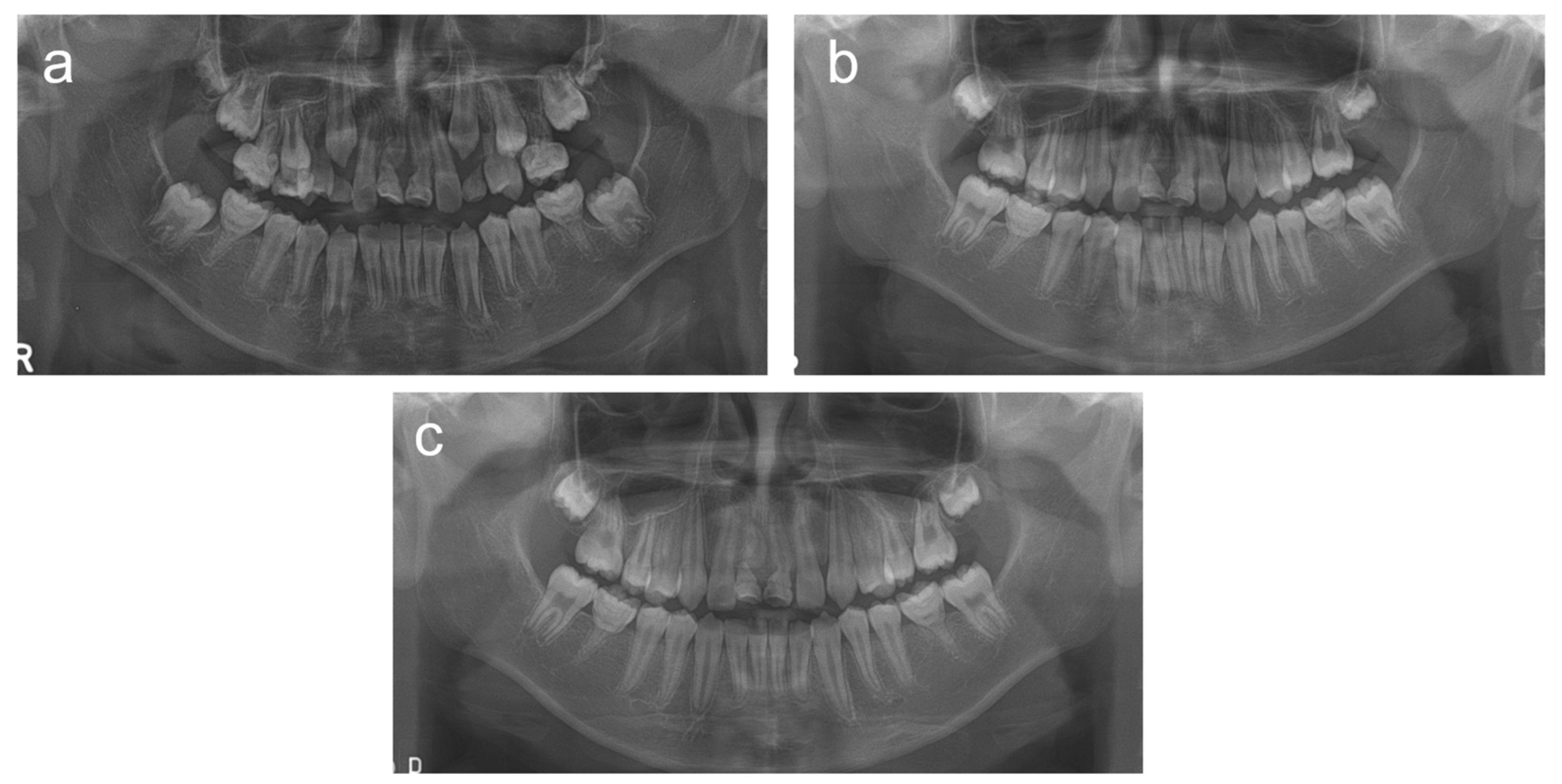 Children 08 00904 g003 Children 08 00904 g003