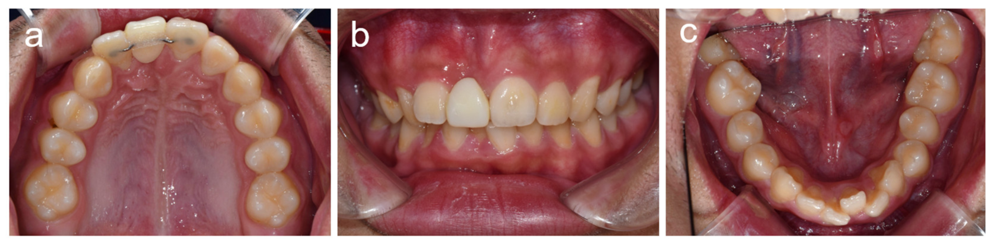 Children 08 00904 g005 Children 08 00904 g005