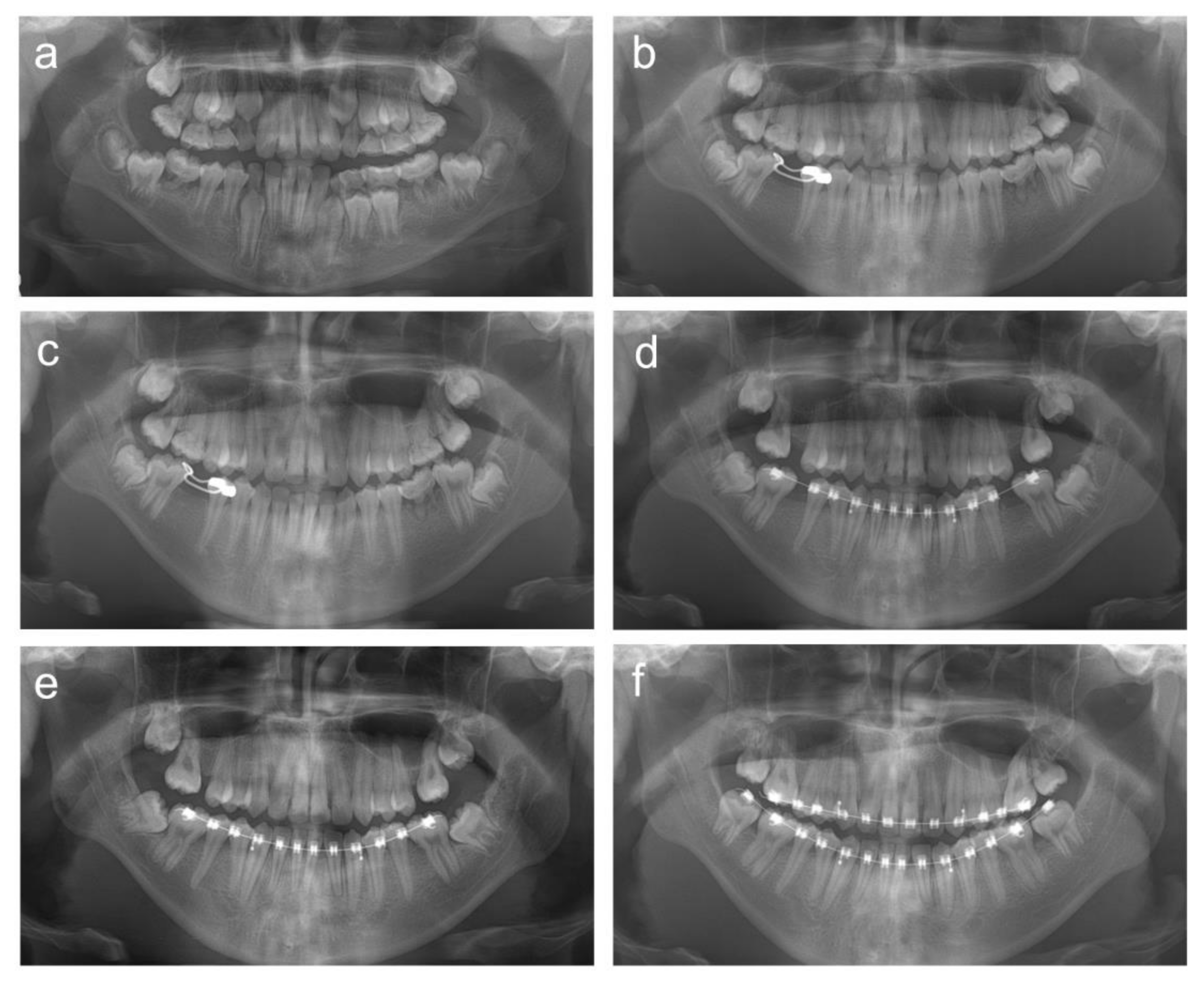 Children 08 00904 g006 Children 08 00904 g006