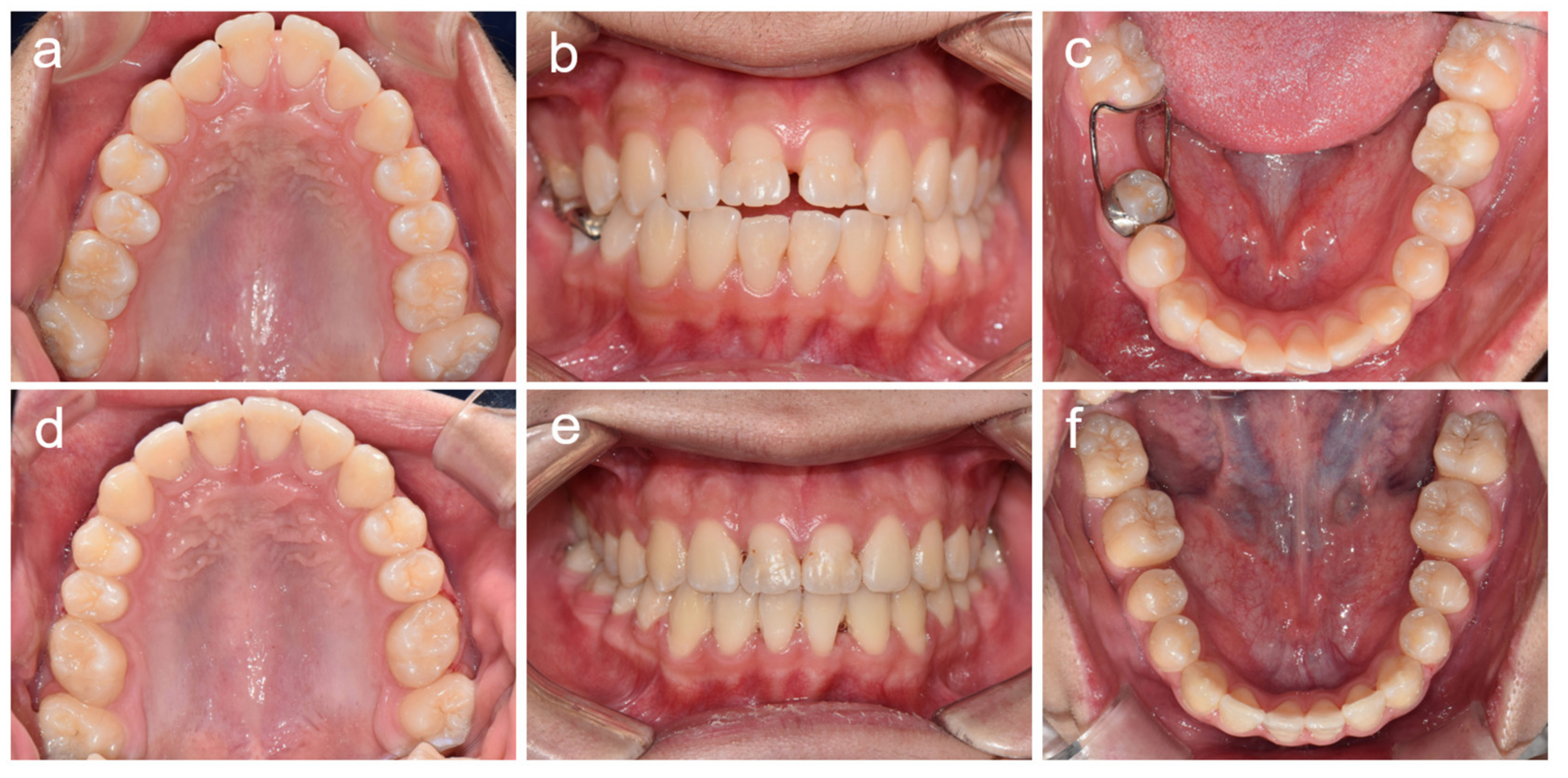 Children 08 00904 g007 Children 08 00904 g007