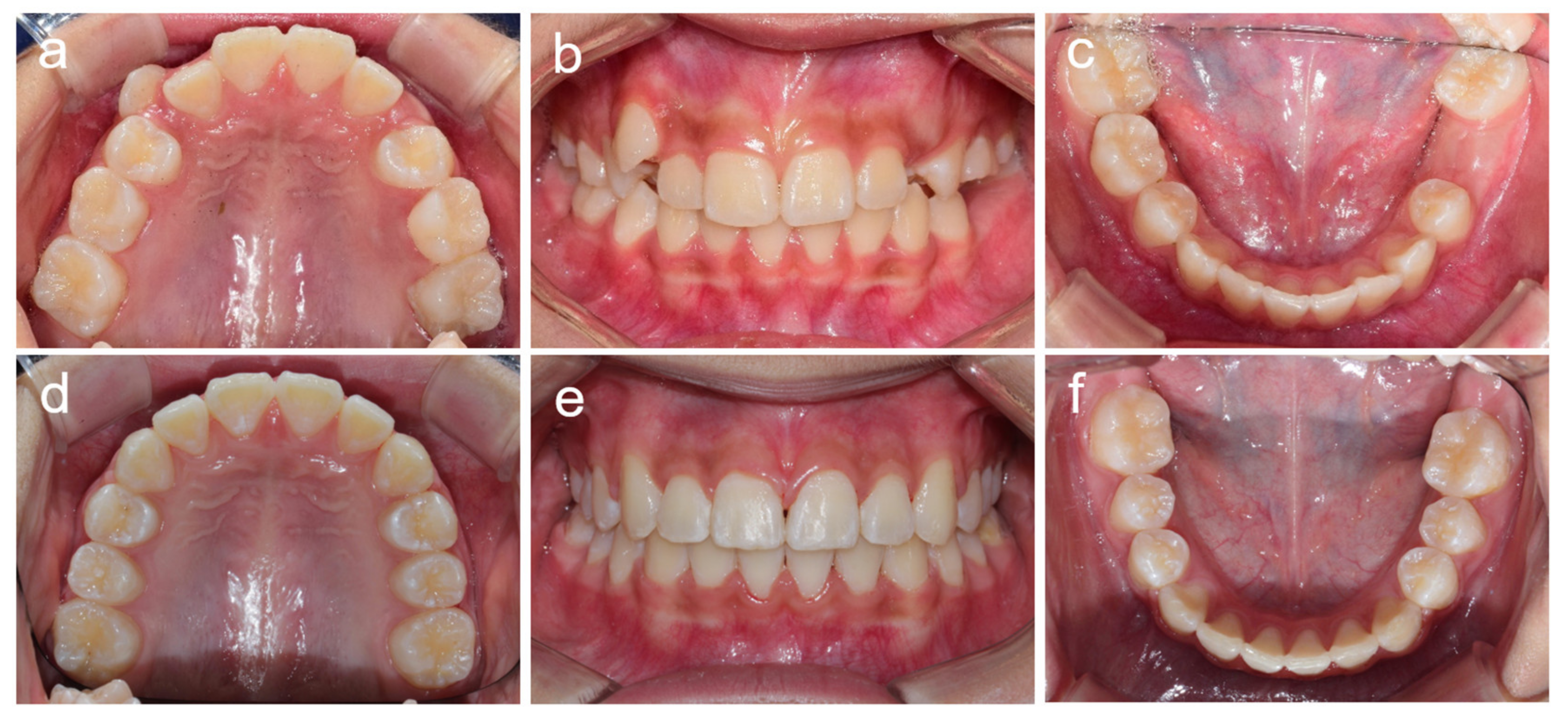 Children 08 00904 g009 Children 08 00904 g009