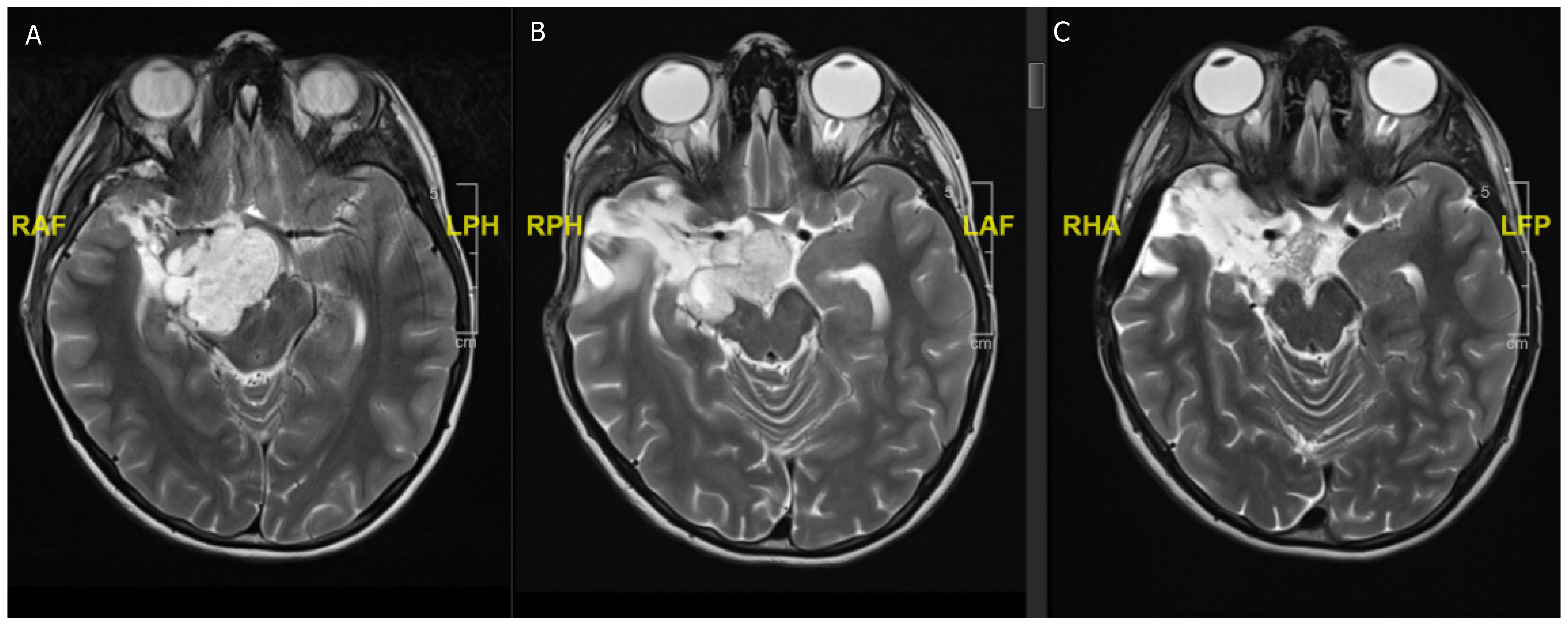 Children 08 01075 g003