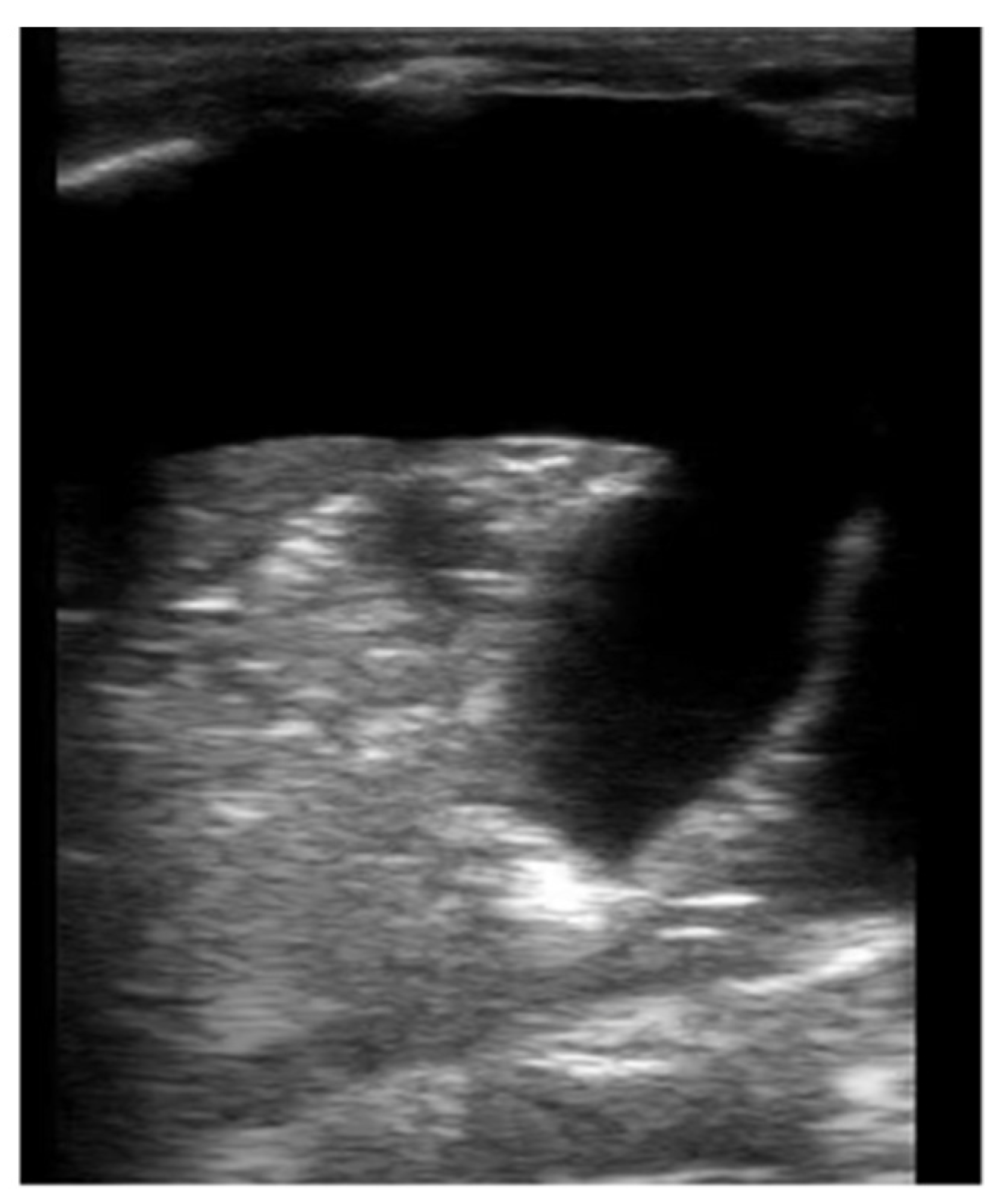 Children 08 01098 g004