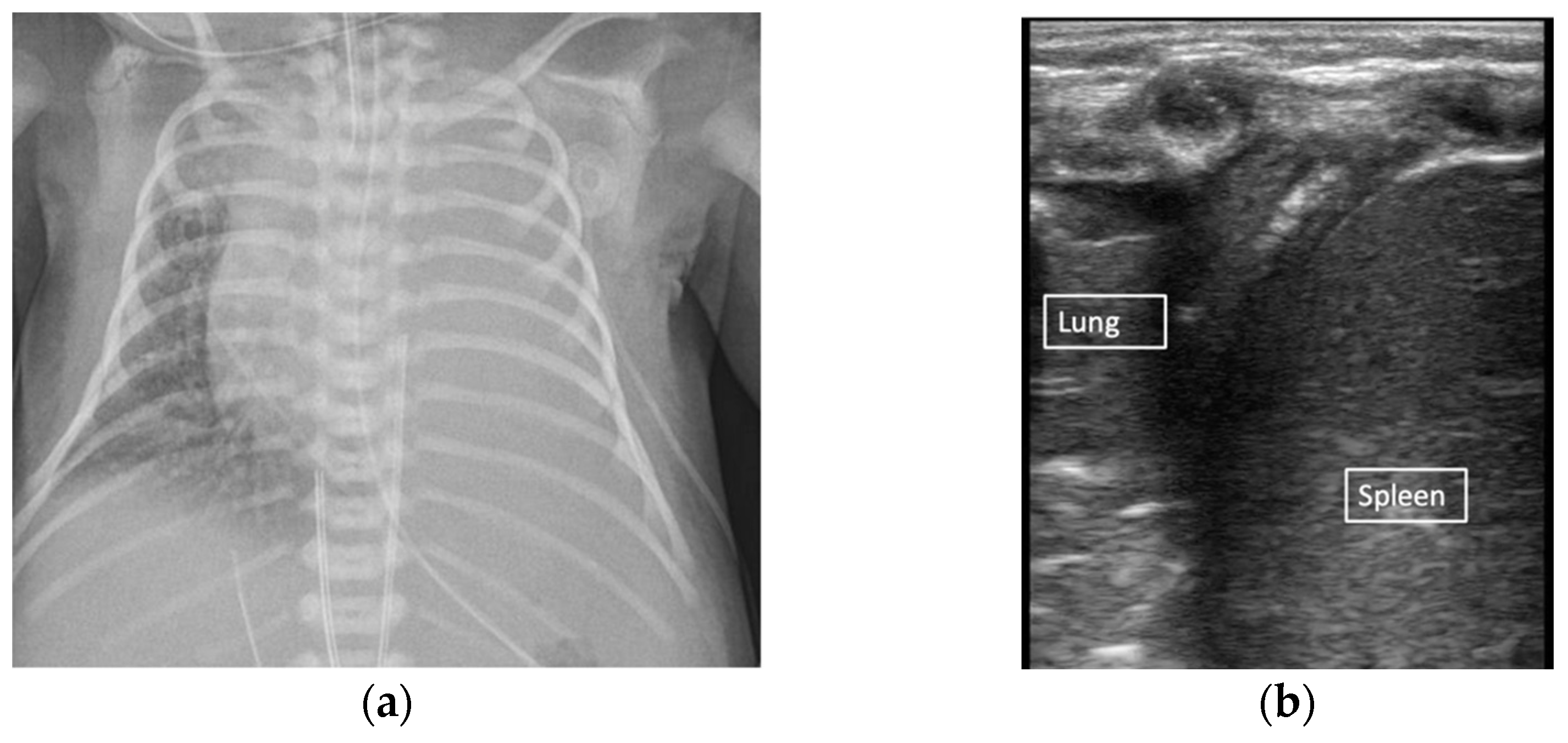 Children 08 01098 g005