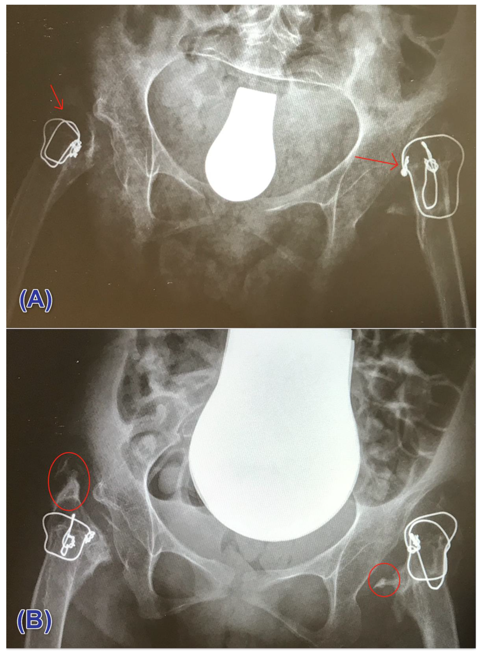 Children 08 01105 g004 Children 08 01105 g004