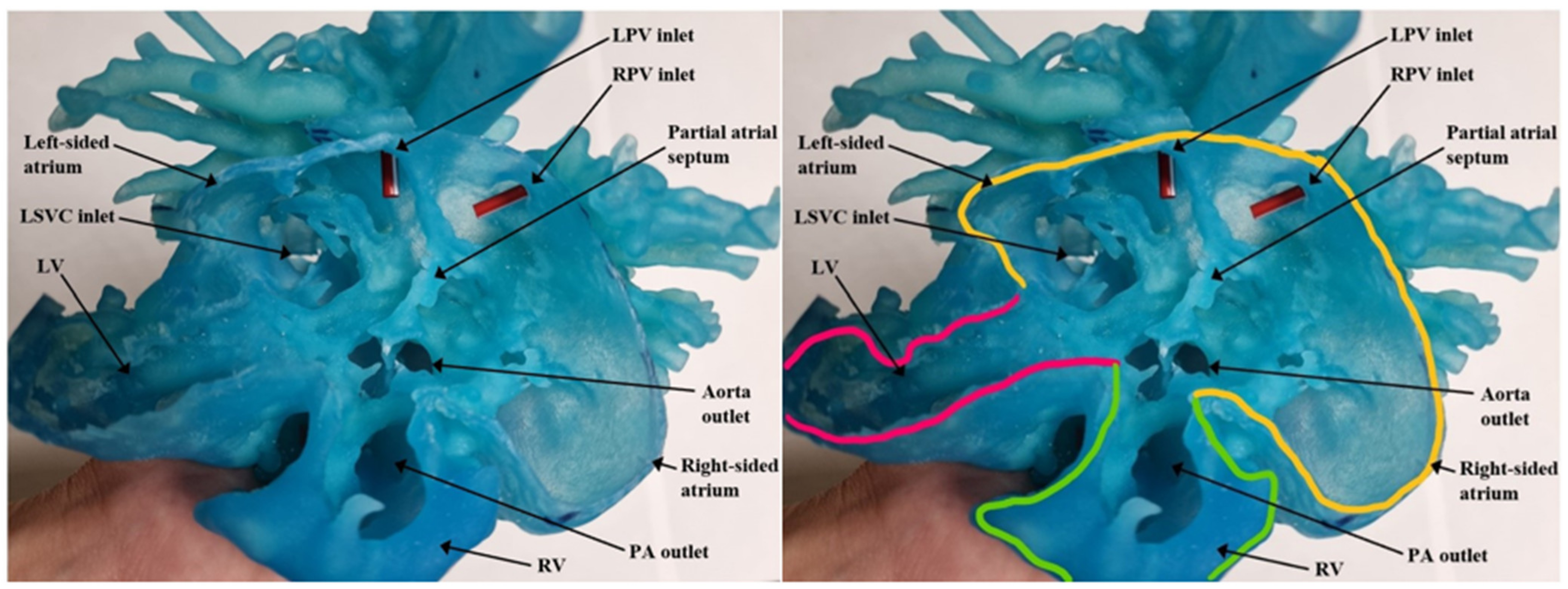 Children 09 00184 g004