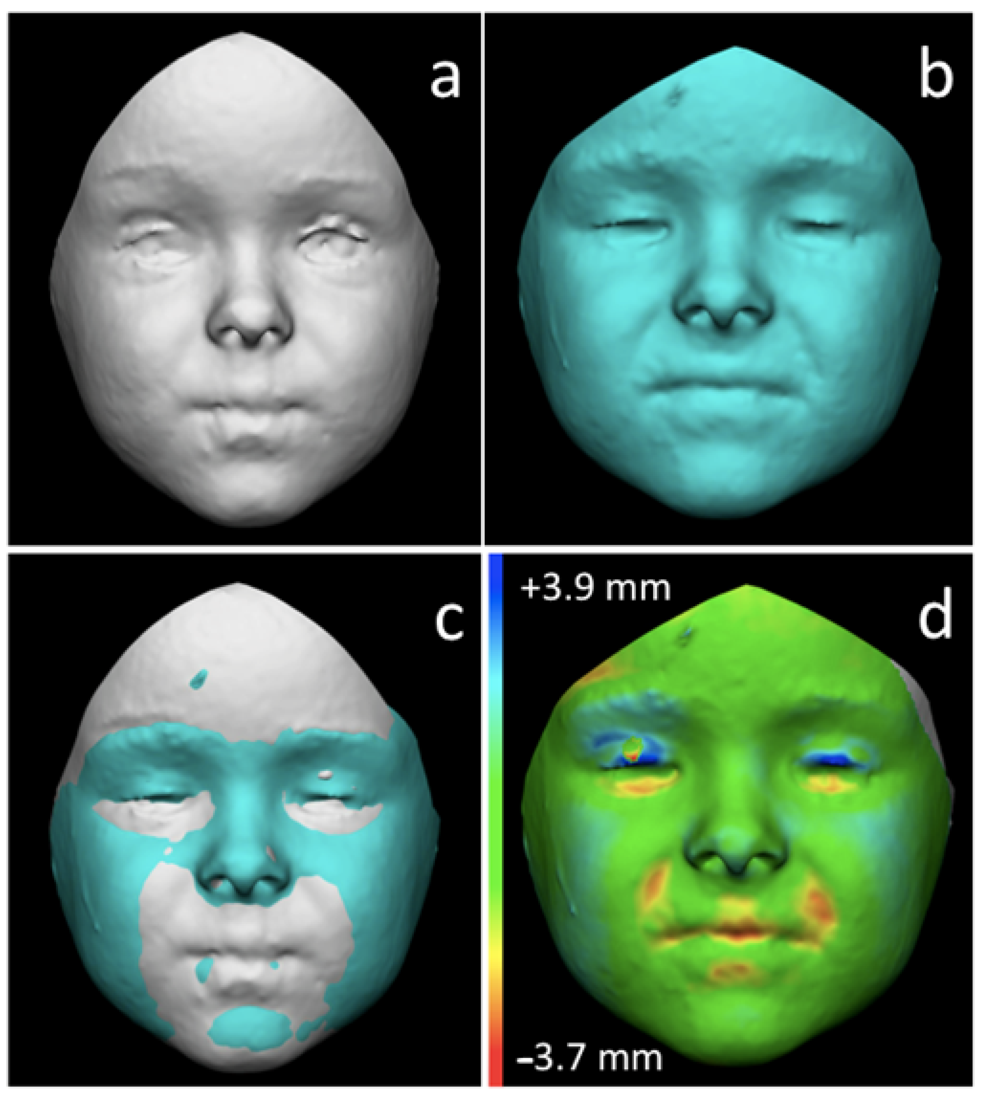 Children 09 00187 g002 Children 09 00187 g002