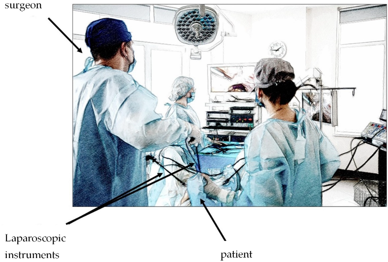 Parent and Patient Perceptions of Robotic vs Open Urological