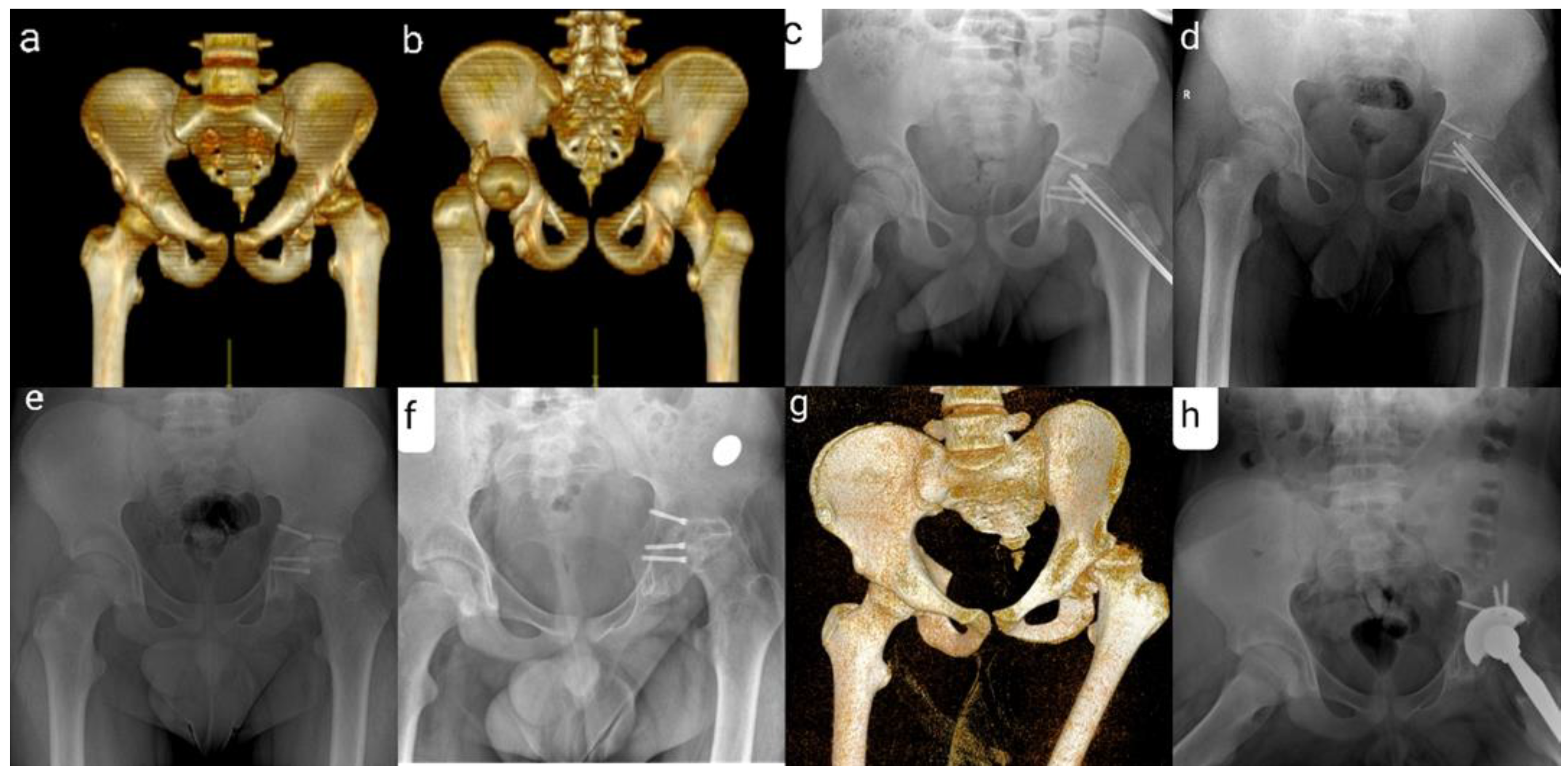 Children 09 00612 g003 Children 09 00612 g003