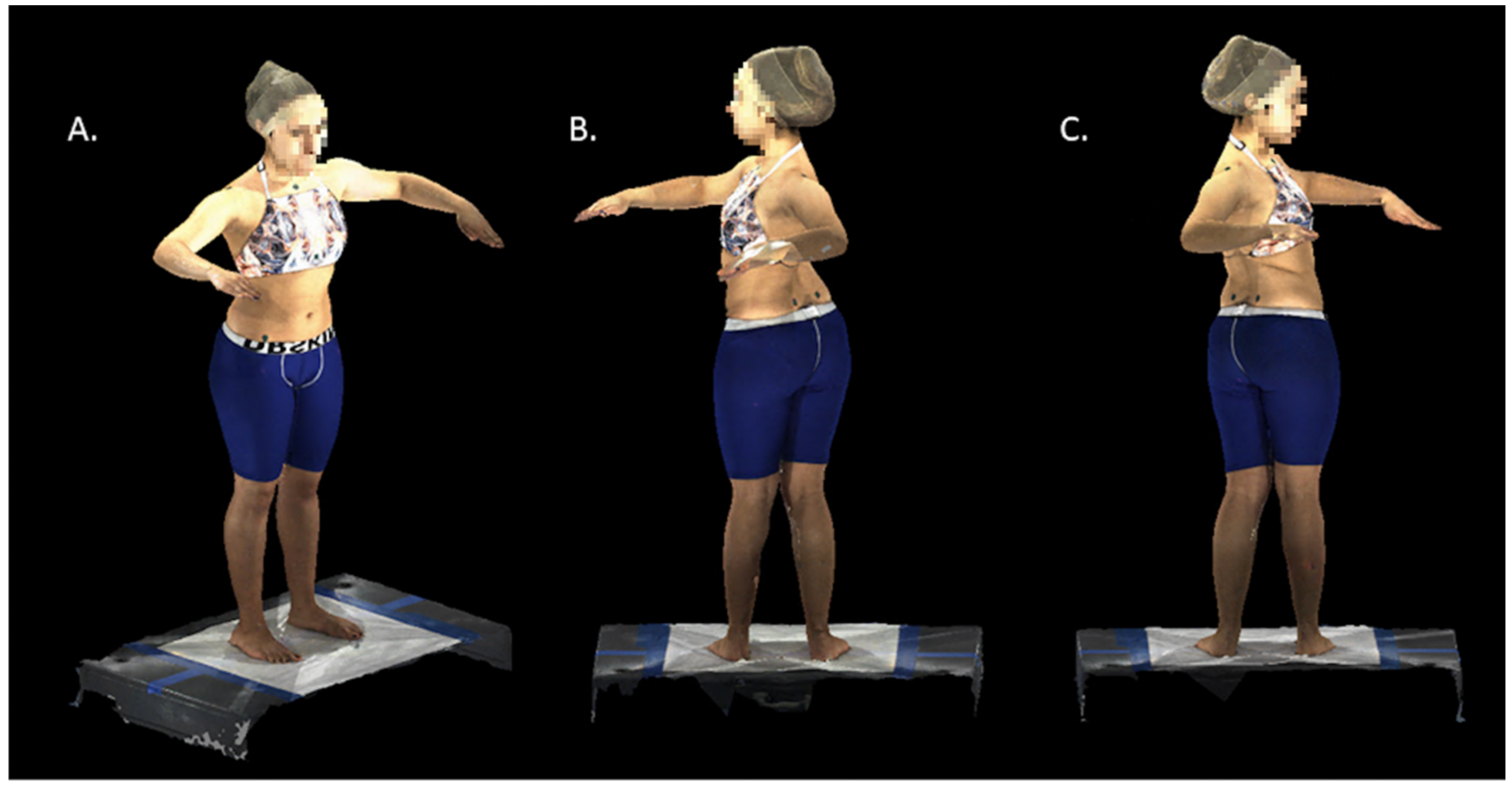 A review of the trunk surface metrics used as Scoliosis and other  deformities evaluation indices – topic of research paper in Medical  engineering. Download scholarly article PDF and read for free on