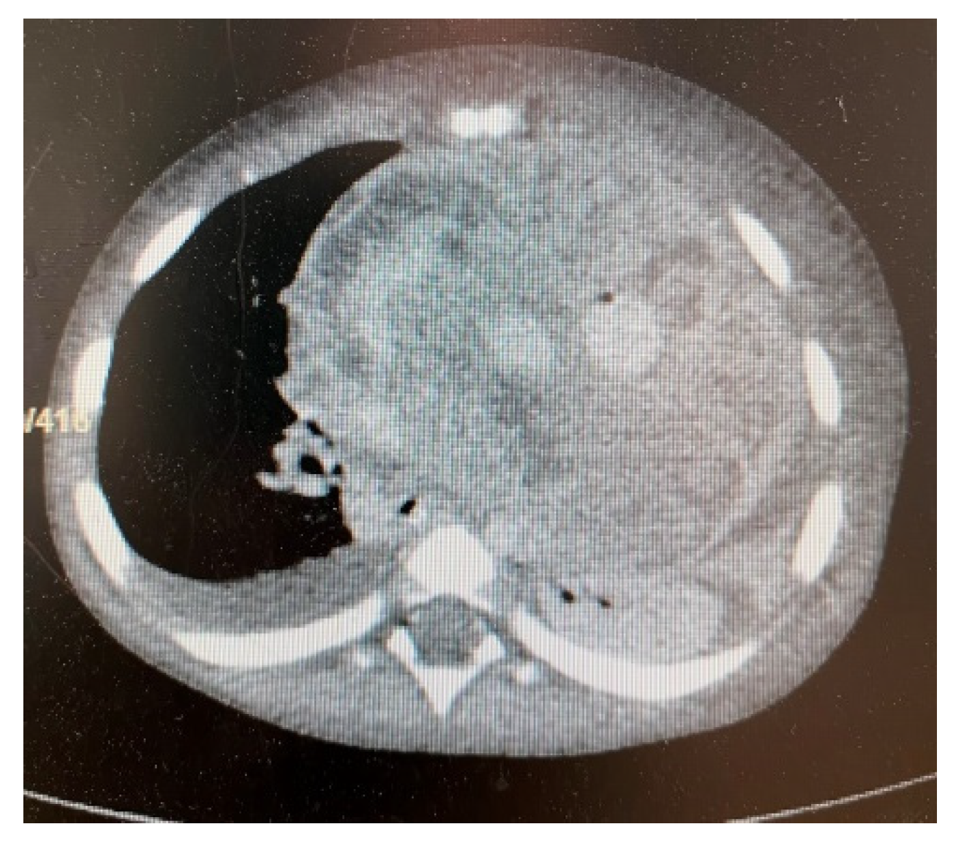 Children 09 00942 g004