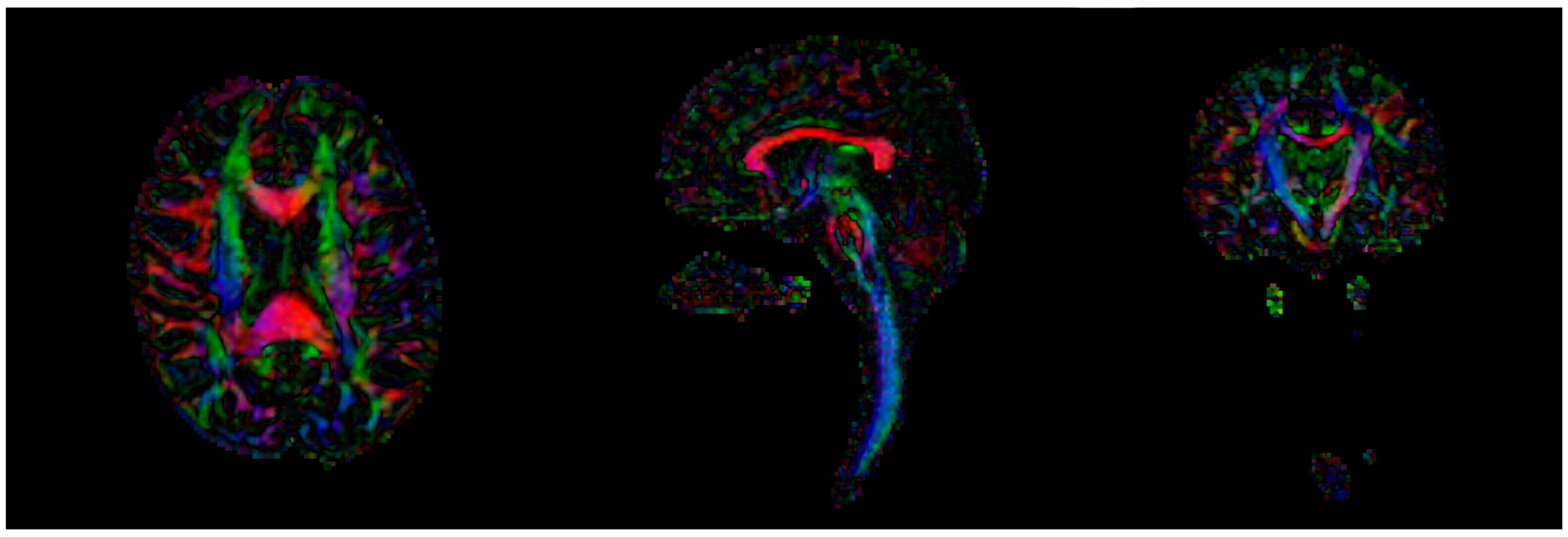 Children 09 01023 g002