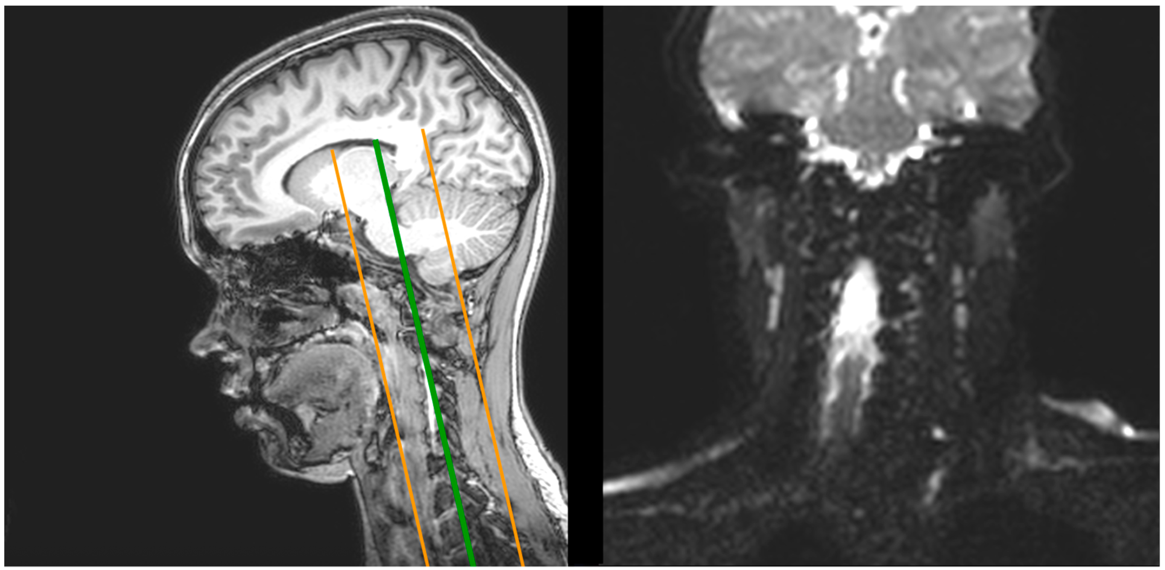 Children 09 01023 g003