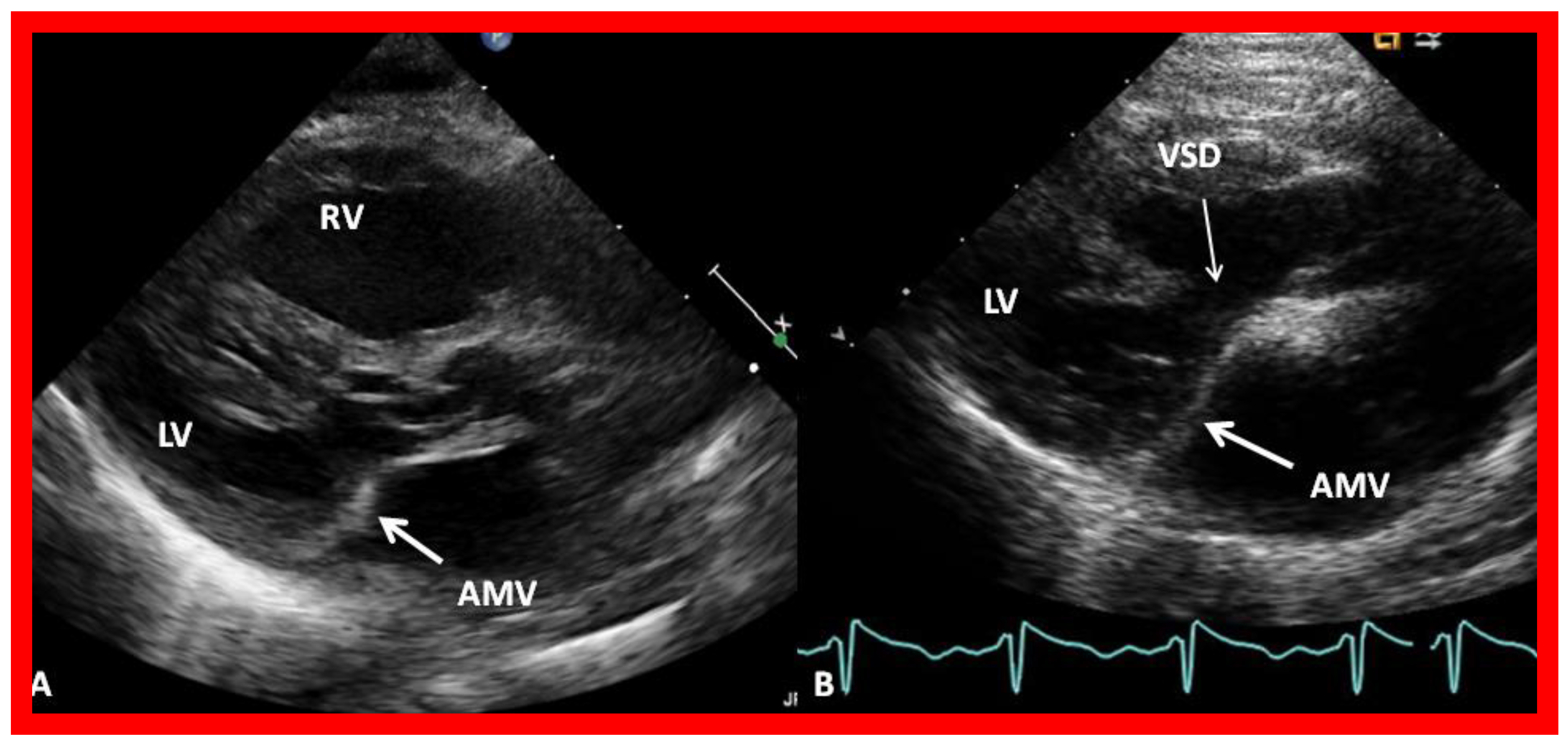 Children 09 01148 g002