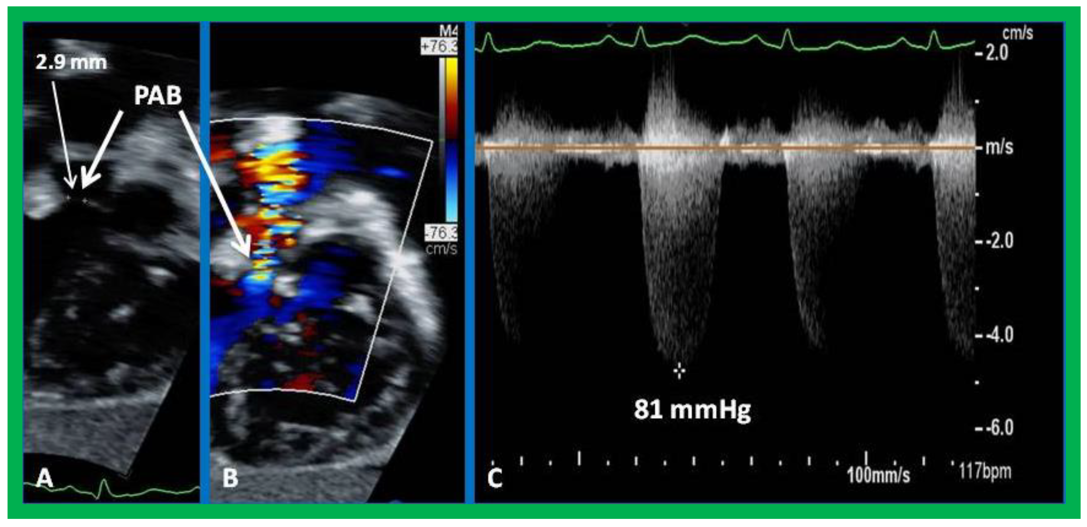 Children 09 01148 g011