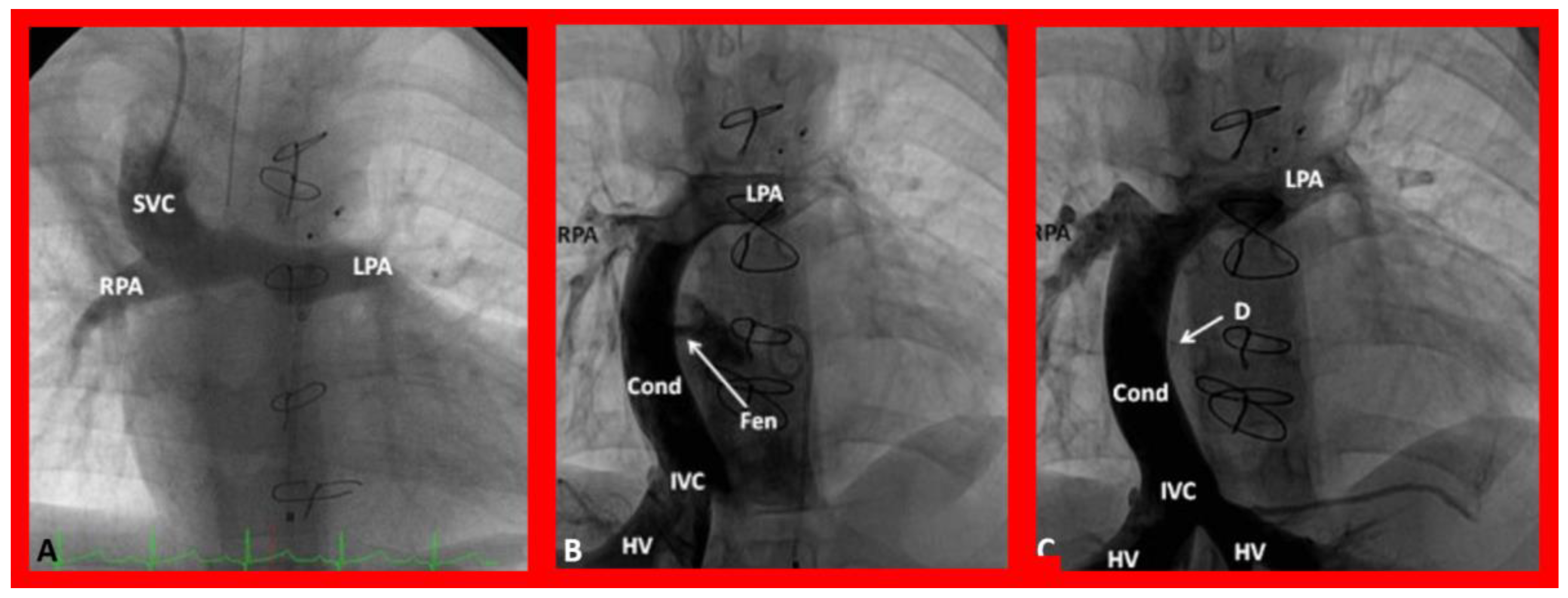 Children 09 01148 g014