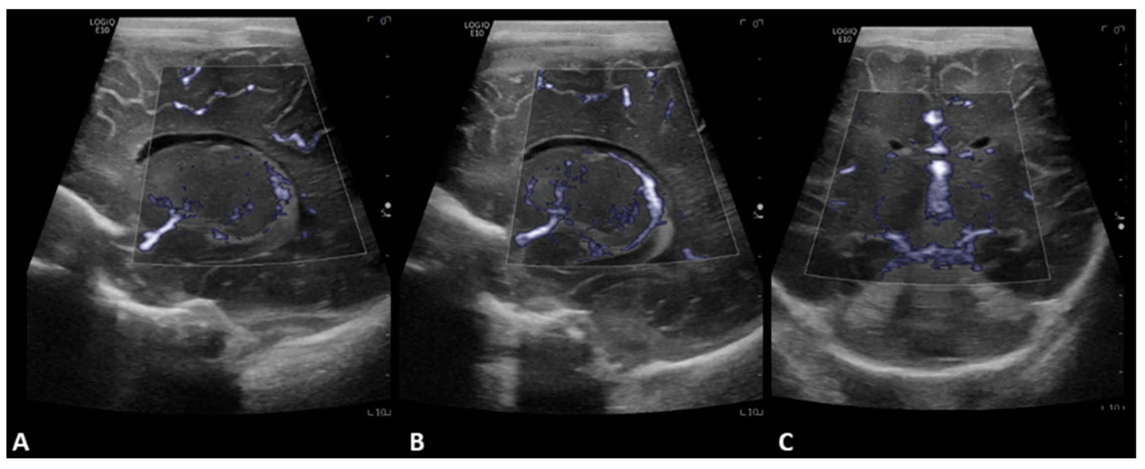 Children 09 01827 g002 Children 09 01827 g002