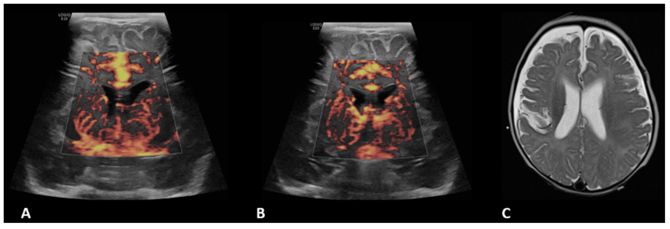 Children 09 01827 g005 Children 09 01827 g005