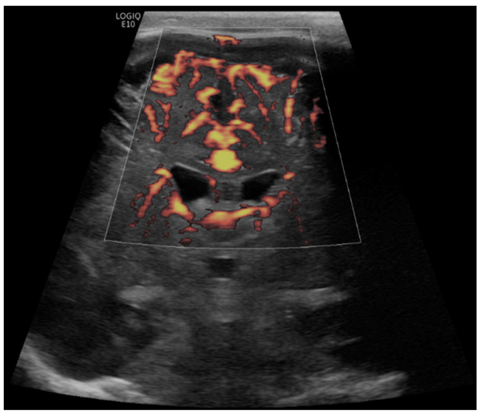 Children 09 01827 g006 Children 09 01827 g006