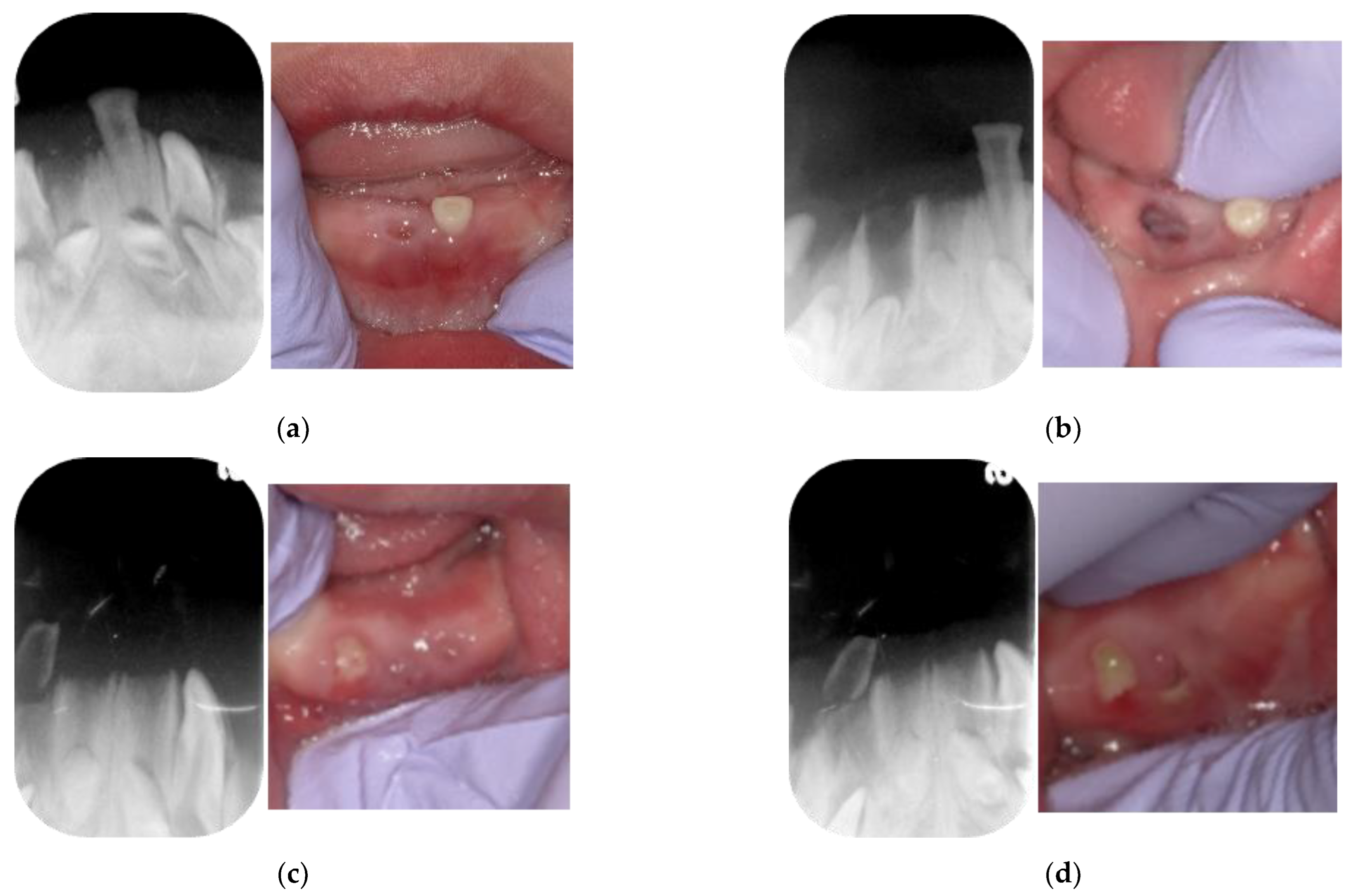 Children 09 01894 g003 Children 09 01894 g003