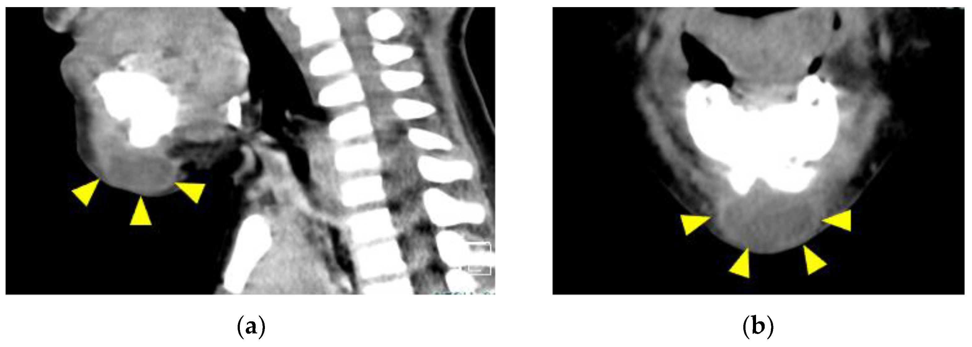 Children 09 01894 g004 Children 09 01894 g004