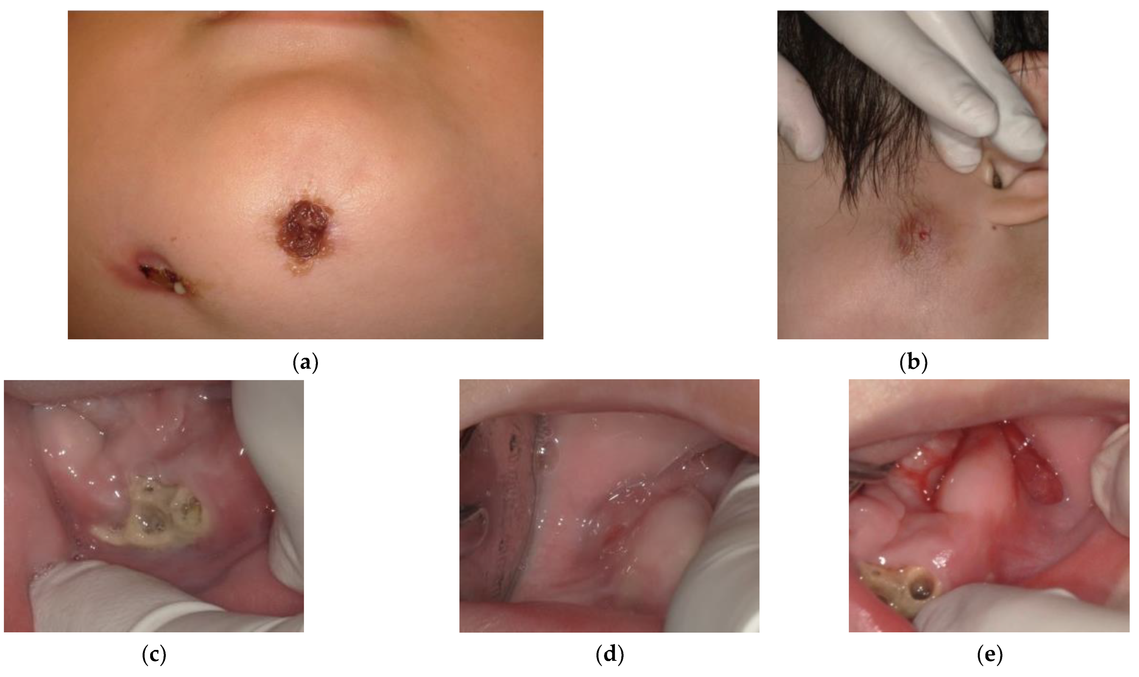 Children 09 01894 g007 Children 09 01894 g007