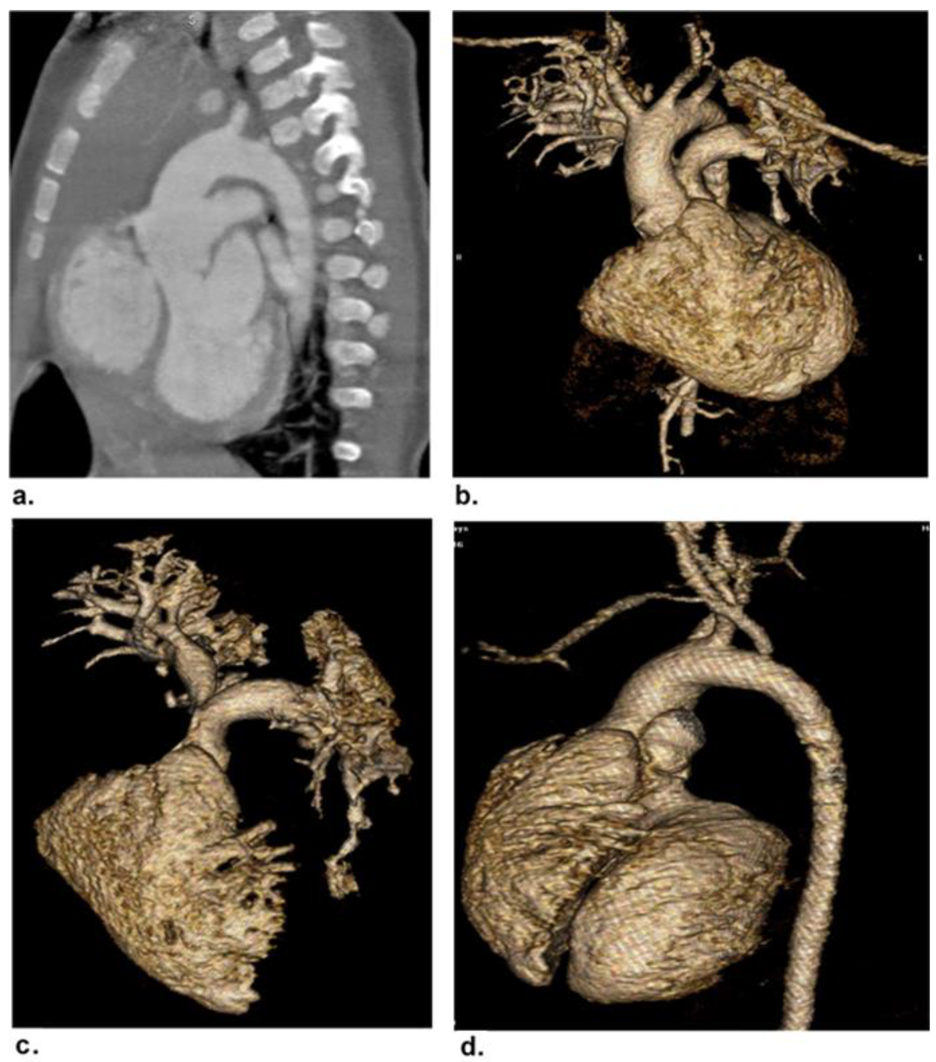 Children 09 01903 g002