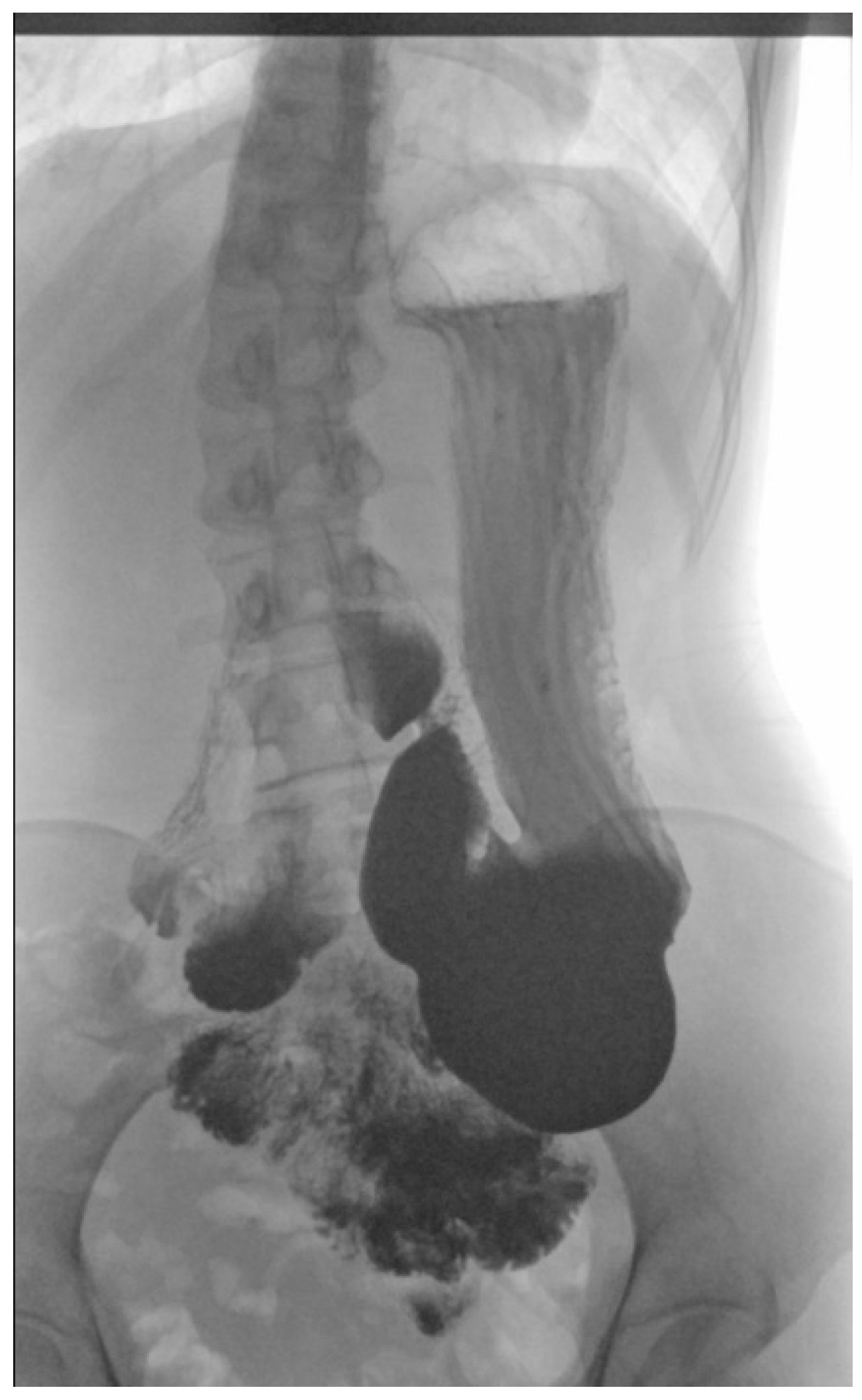 Children | Free Full-Text | Postprandial Abdominal Pain Caused by  Gastroptosis&mdash;A Case Report