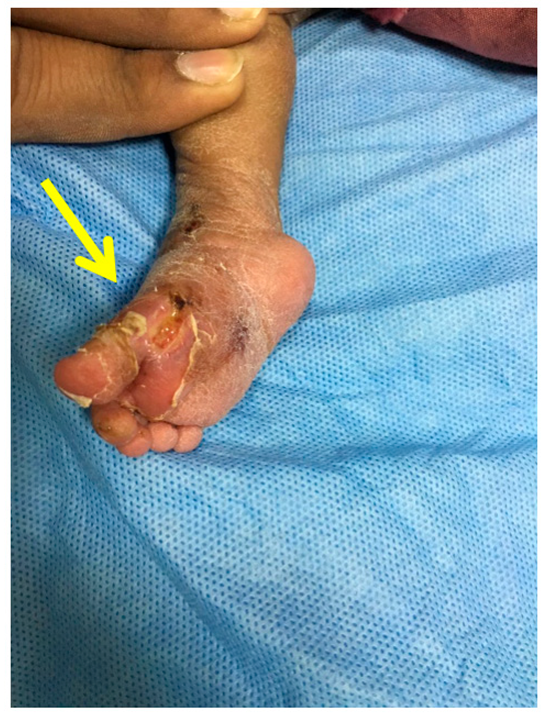 Children 10 00152 g004 Children 10 00152 g004