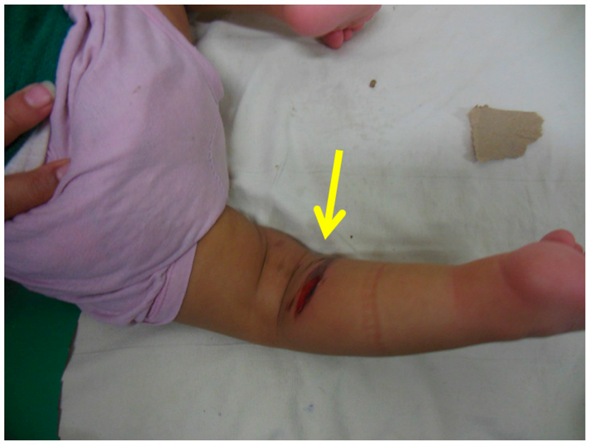 Children 10 00152 g005 Children 10 00152 g005